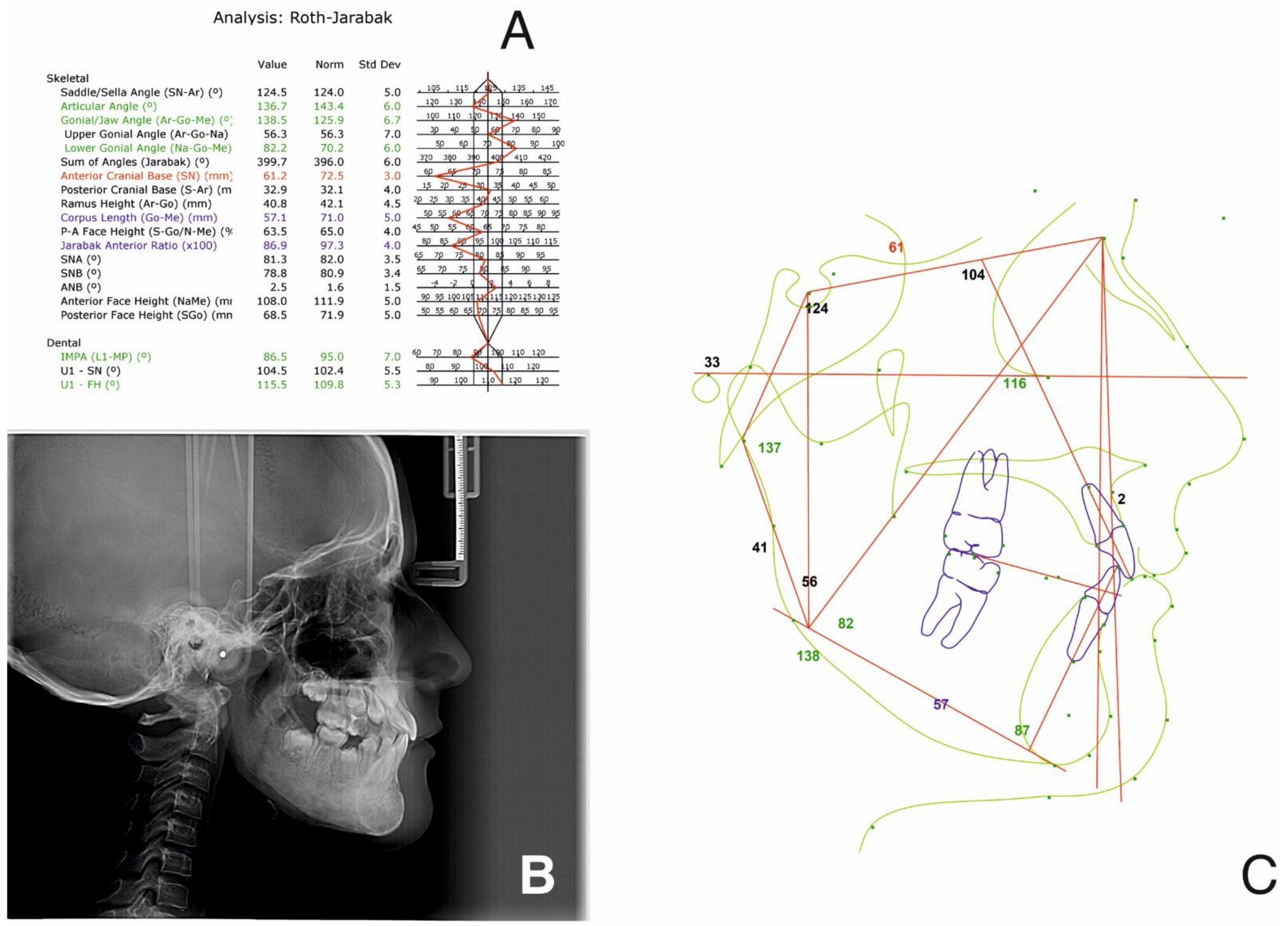 Ijerph 18 03159 g007