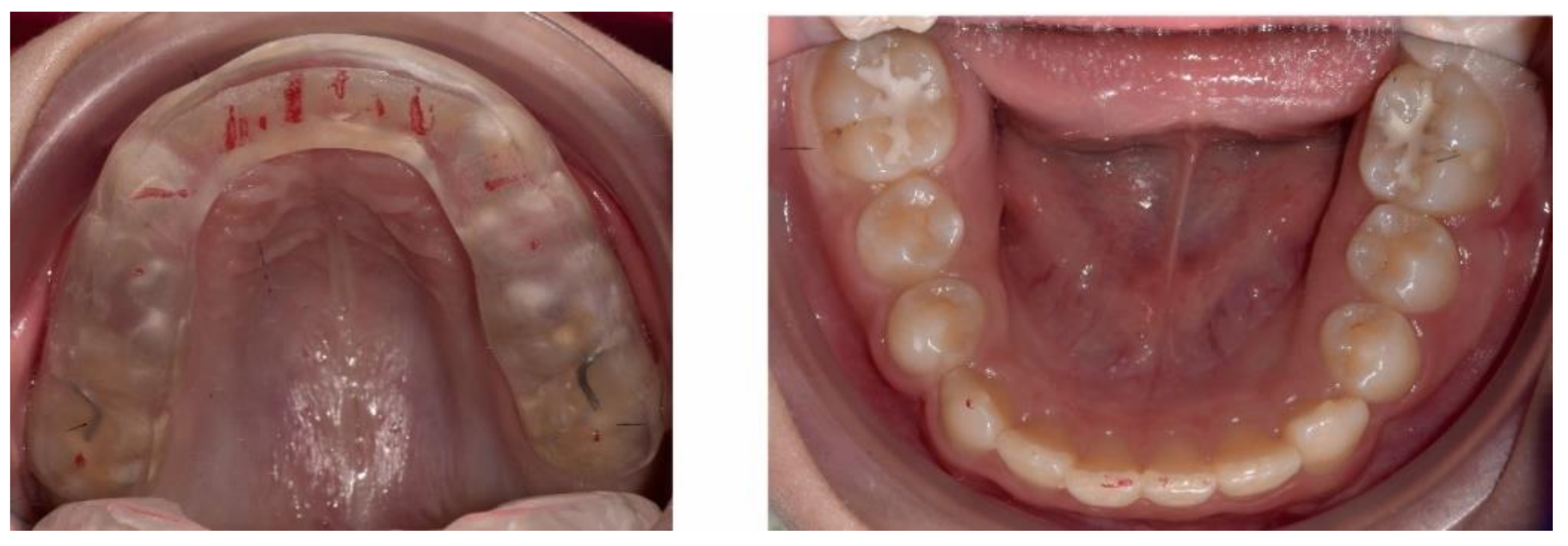 Ijerph 18 03159 g011
