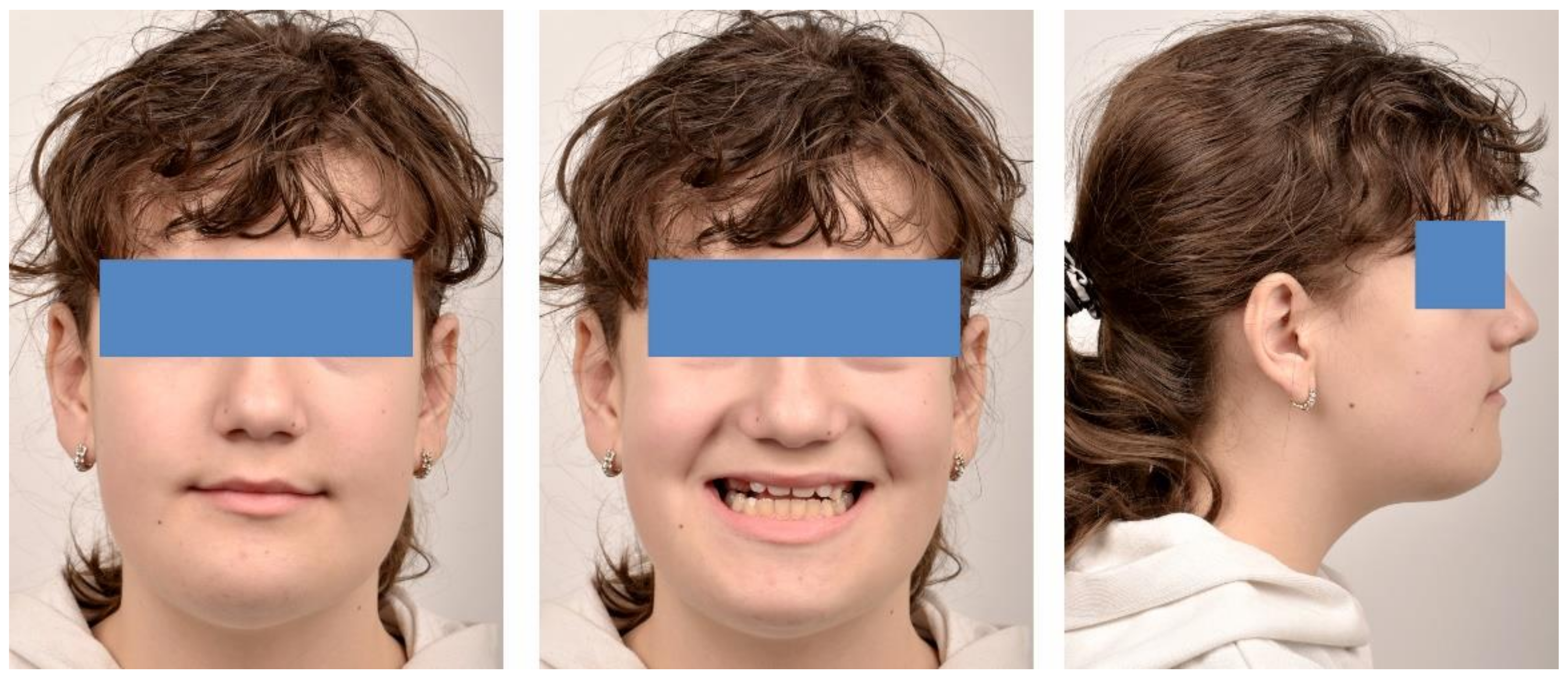 Ijerph 18 03159 g012