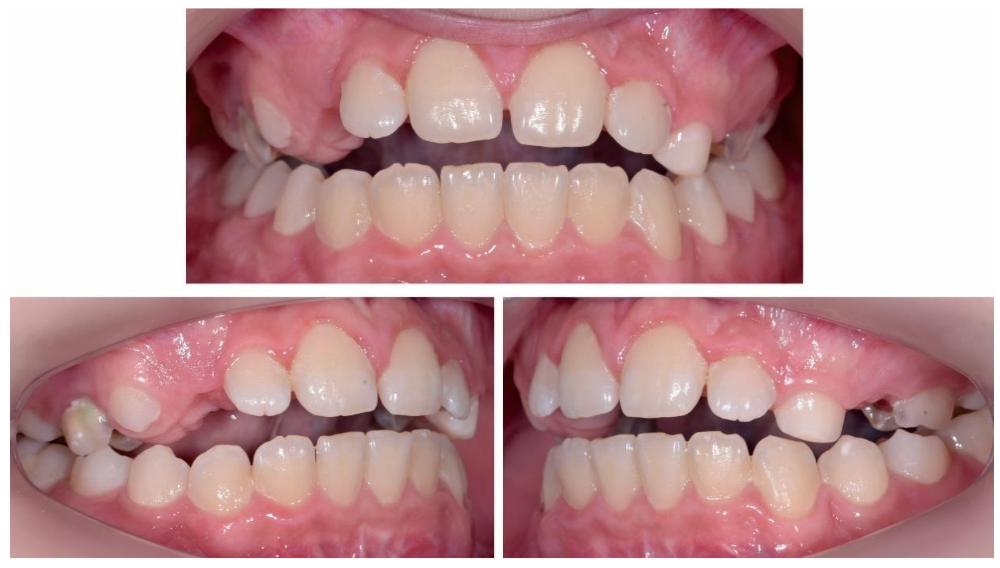 Ijerph 18 03159 g013