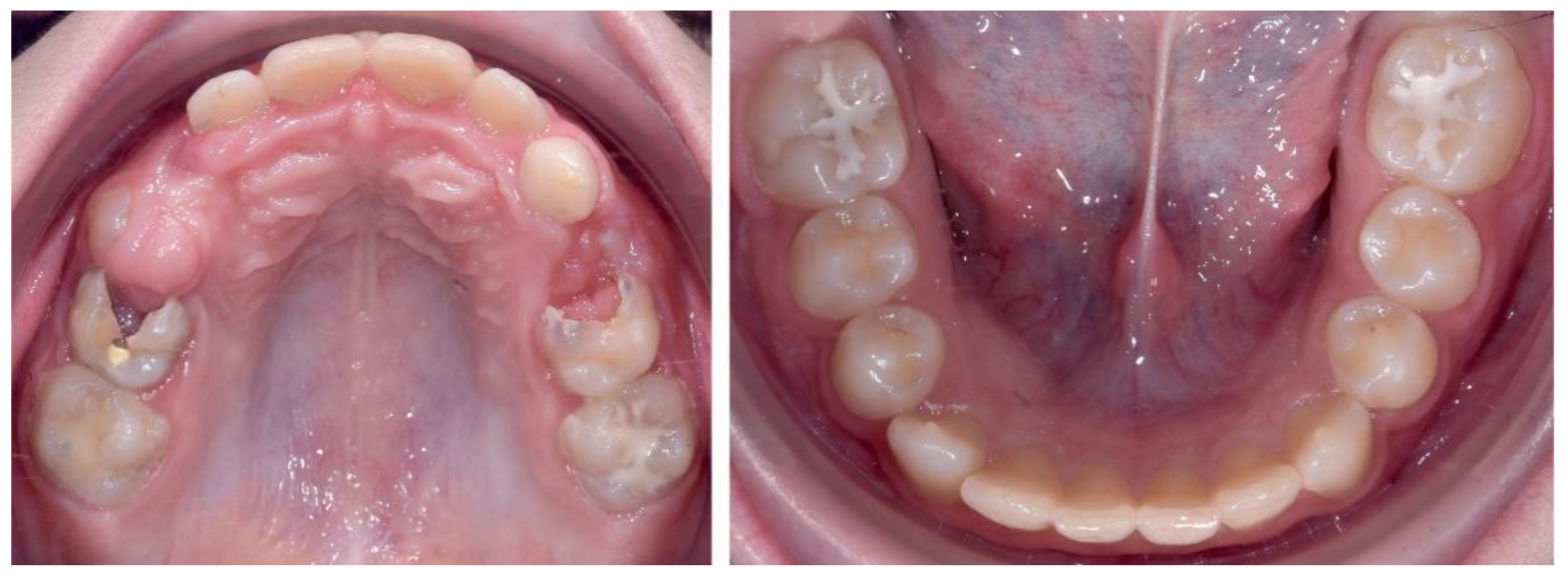 Ijerph 18 03159 g014