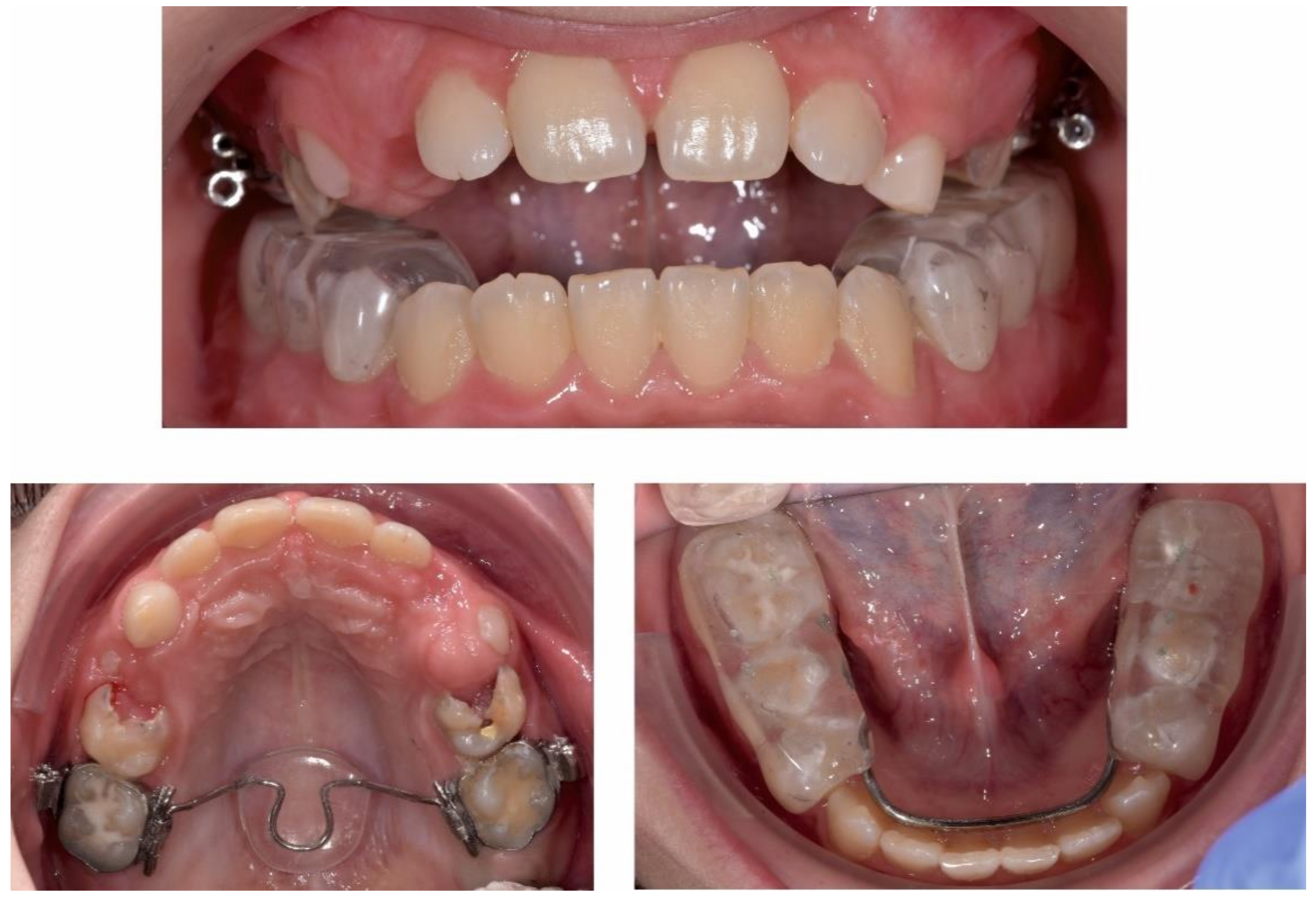 Ijerph 18 03159 g017