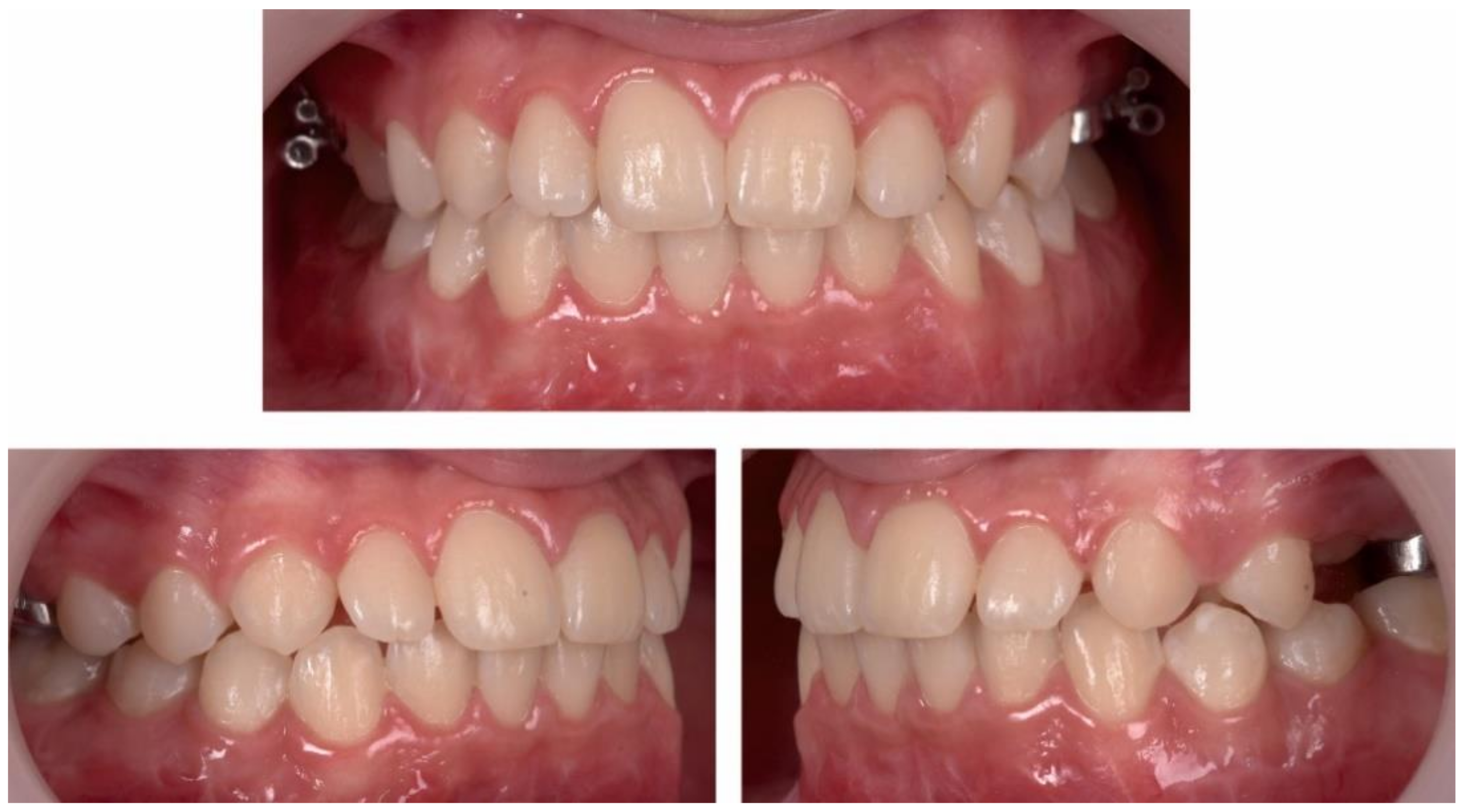 Ijerph 18 03159 g018