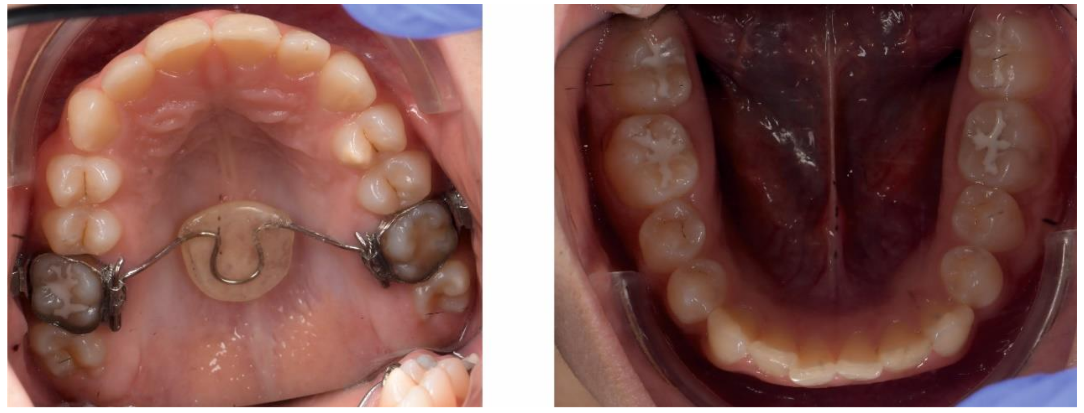 Ijerph 18 03159 g022