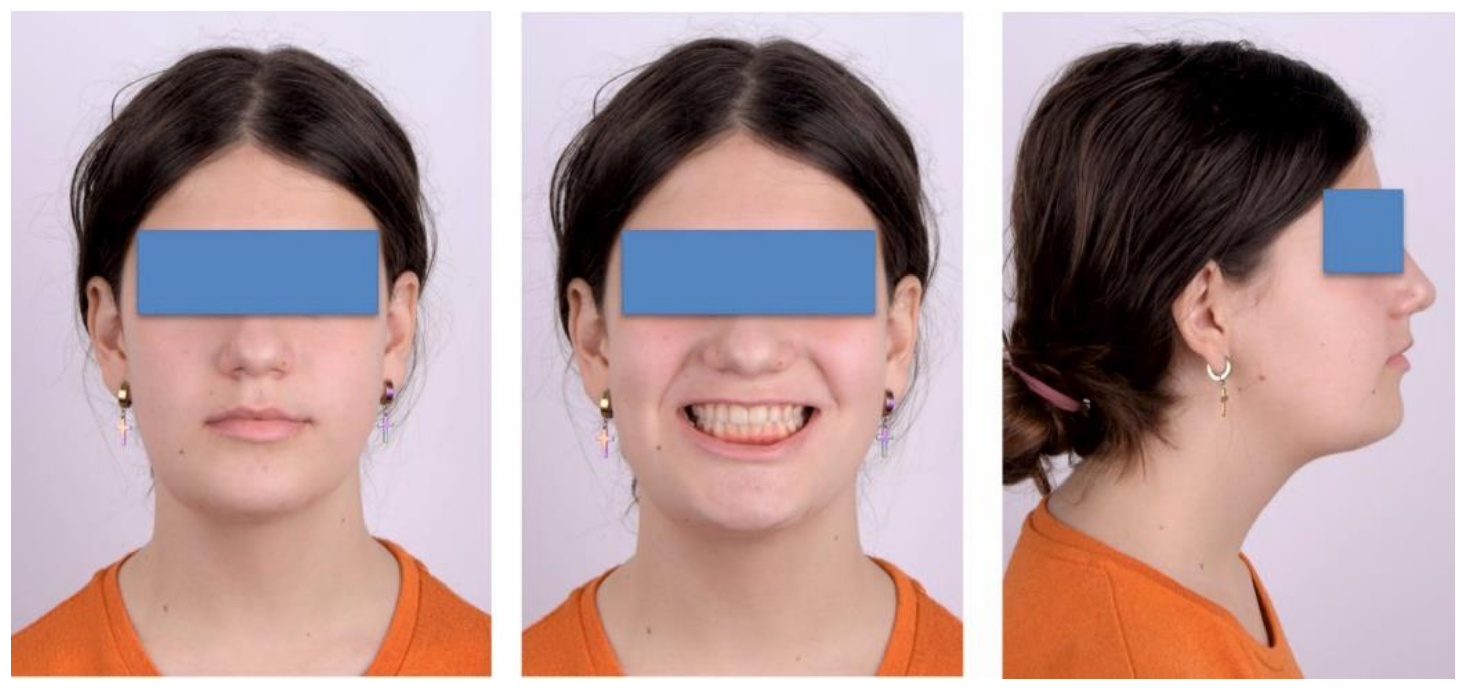 Ijerph 18 03159 g023