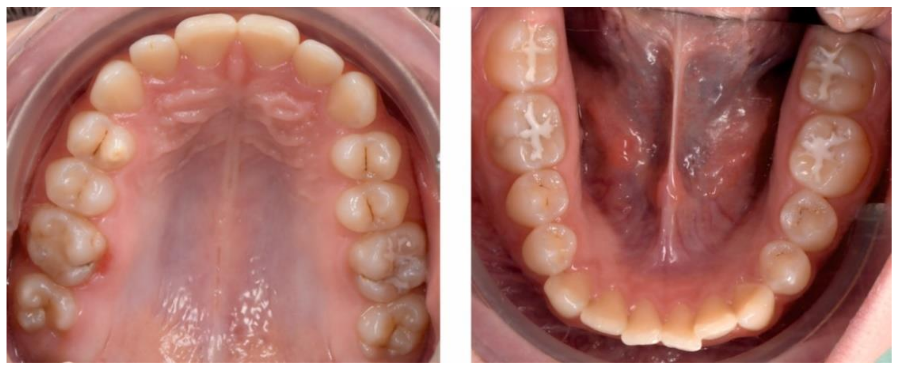 Ijerph 18 03159 g025