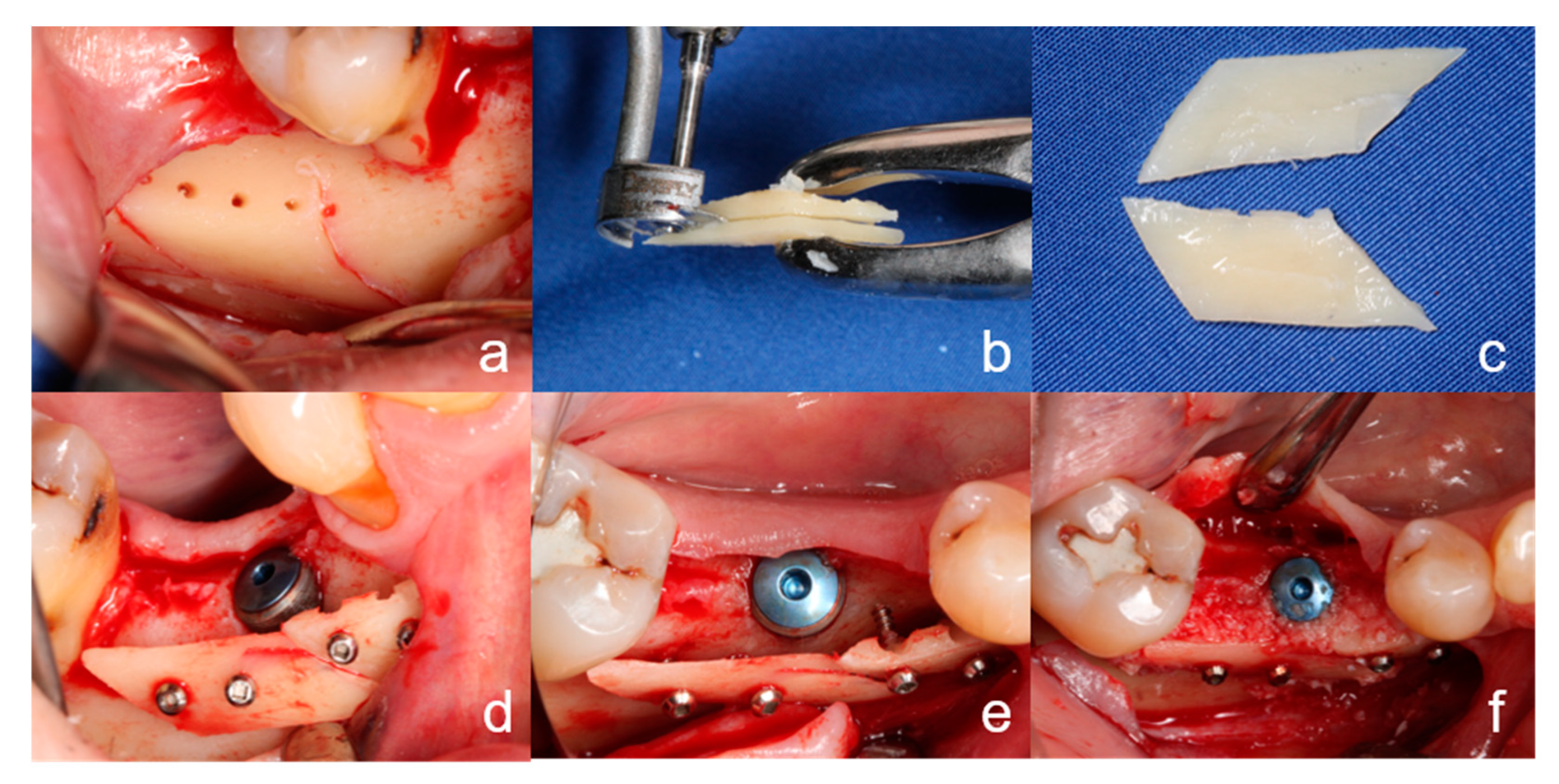 Ijerph 18 03174 g001 Ijerph 18 03174 g001