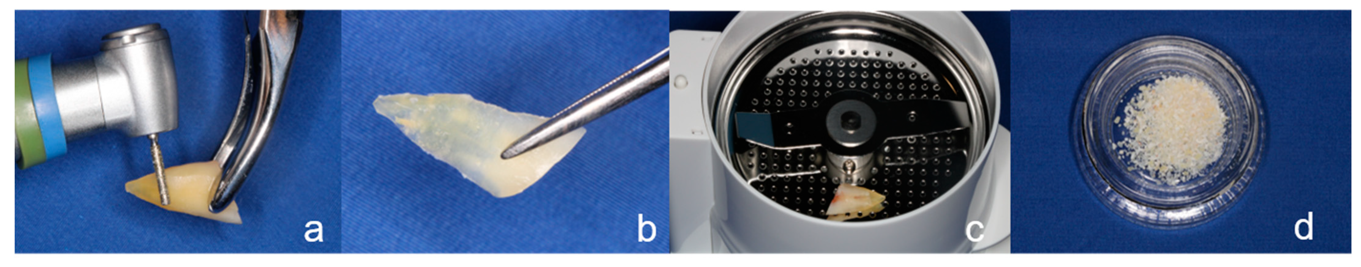 Ijerph 18 03174 g002 Ijerph 18 03174 g002