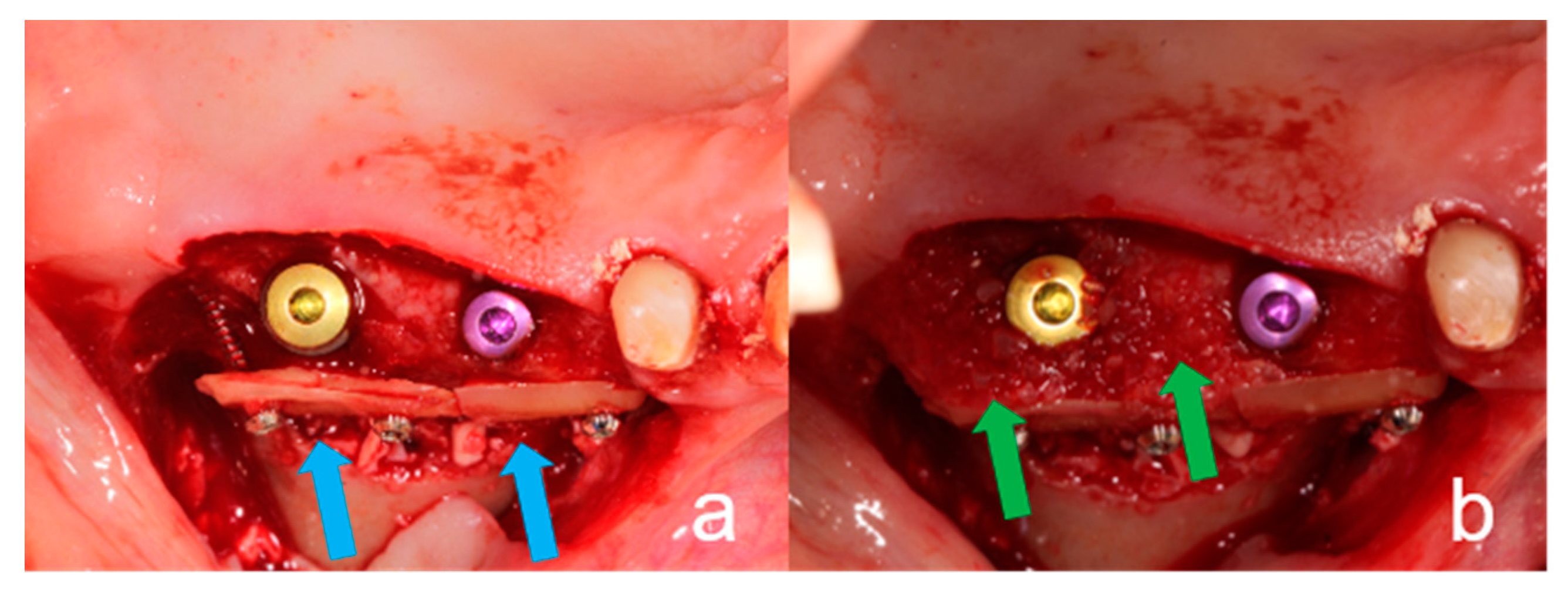 Ijerph 18 03174 g003 Ijerph 18 03174 g003