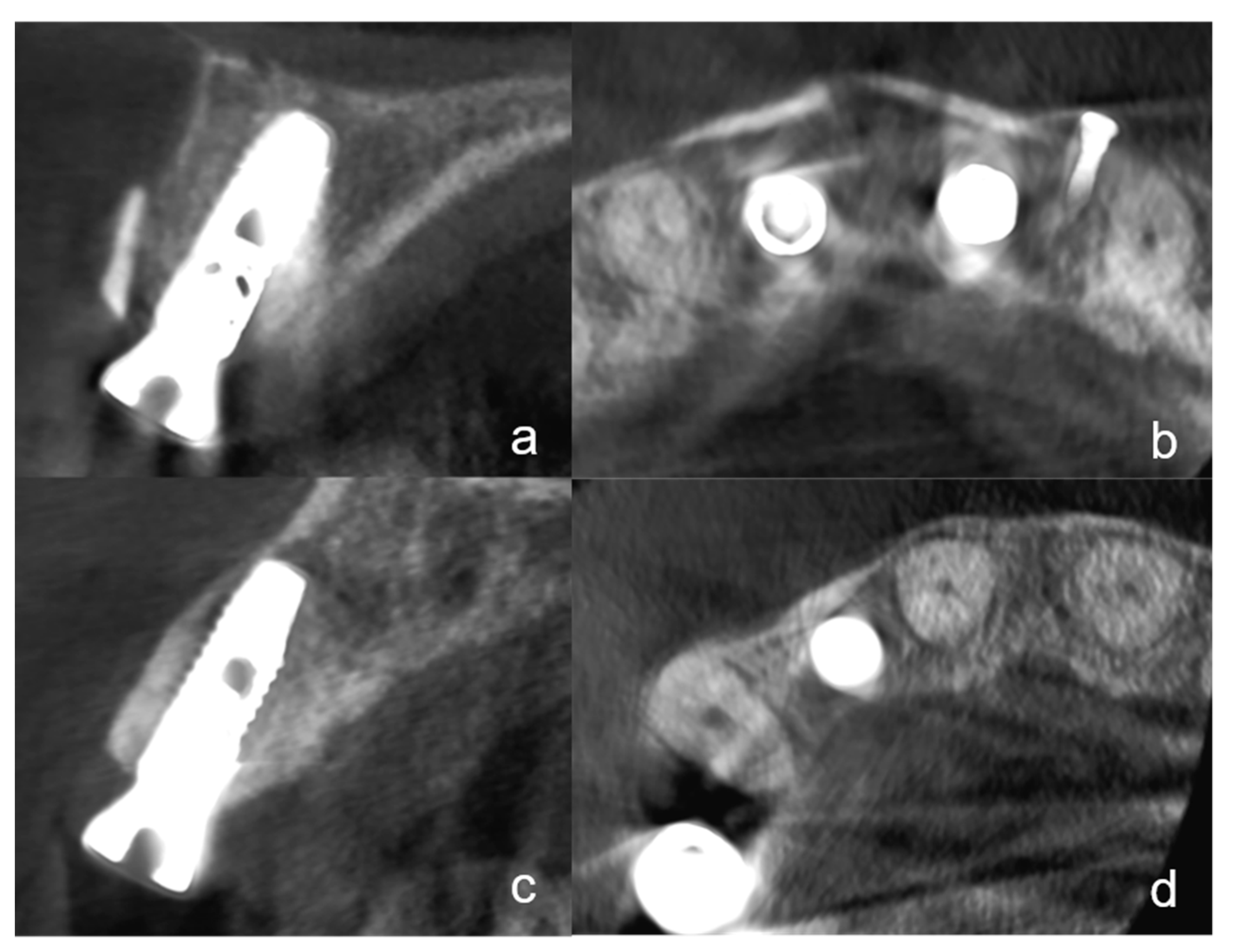 Ijerph 18 03174 g004 Ijerph 18 03174 g004