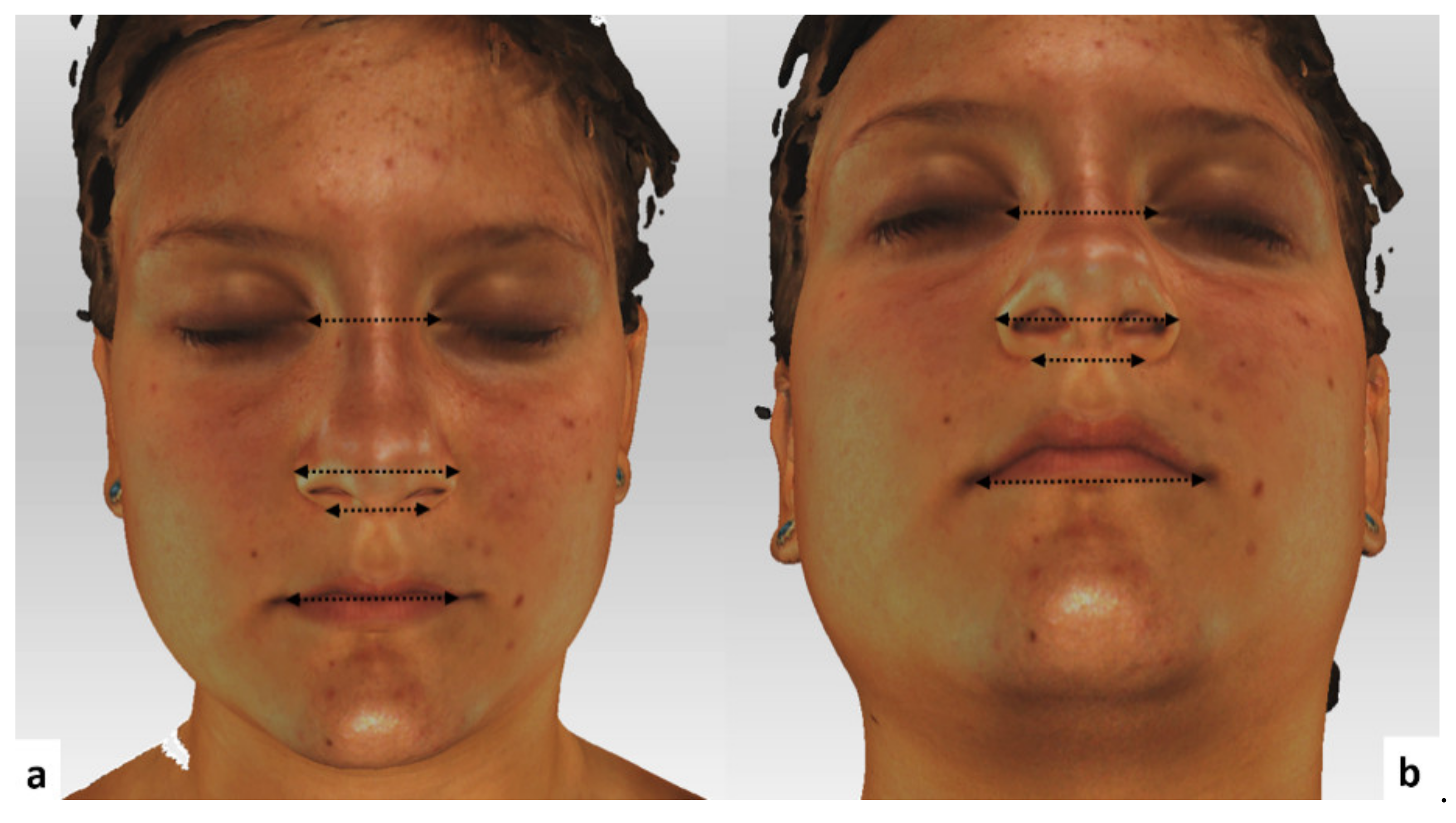 Ijerph 18 03379 g003