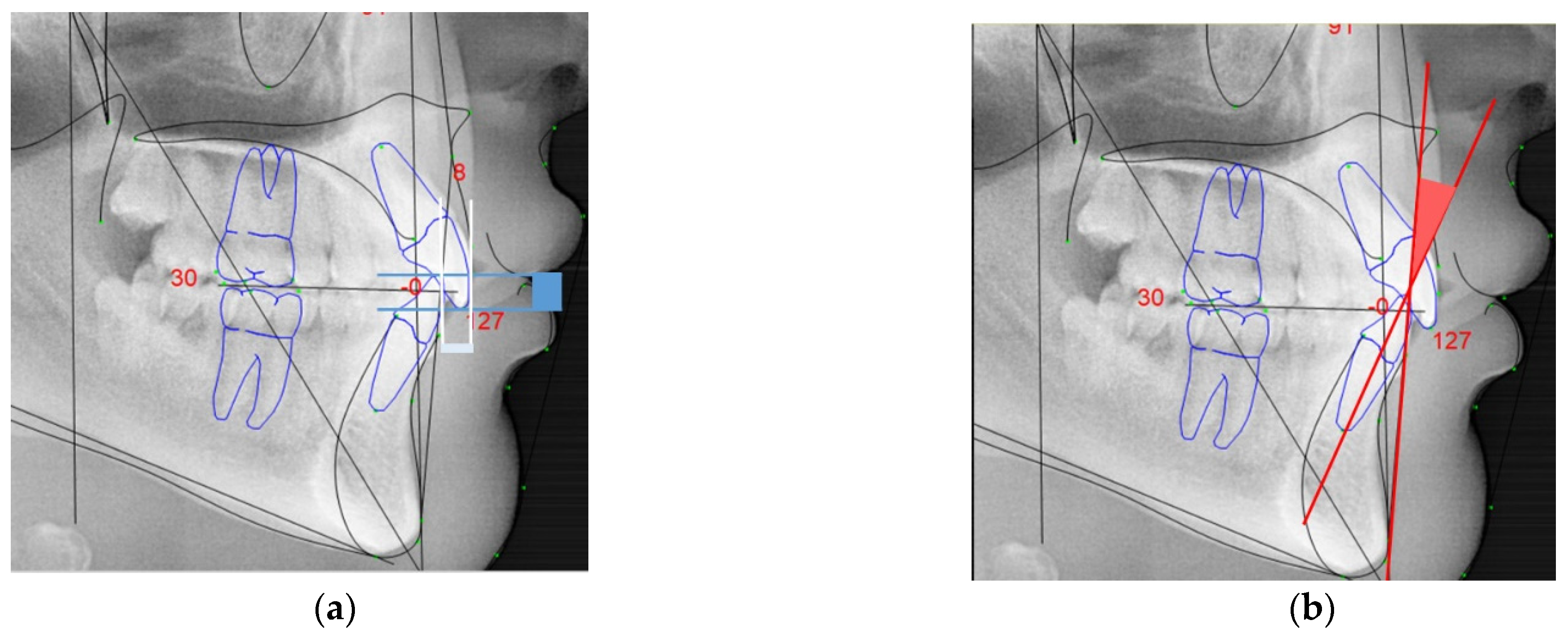 Ijerph 18 04306 g003