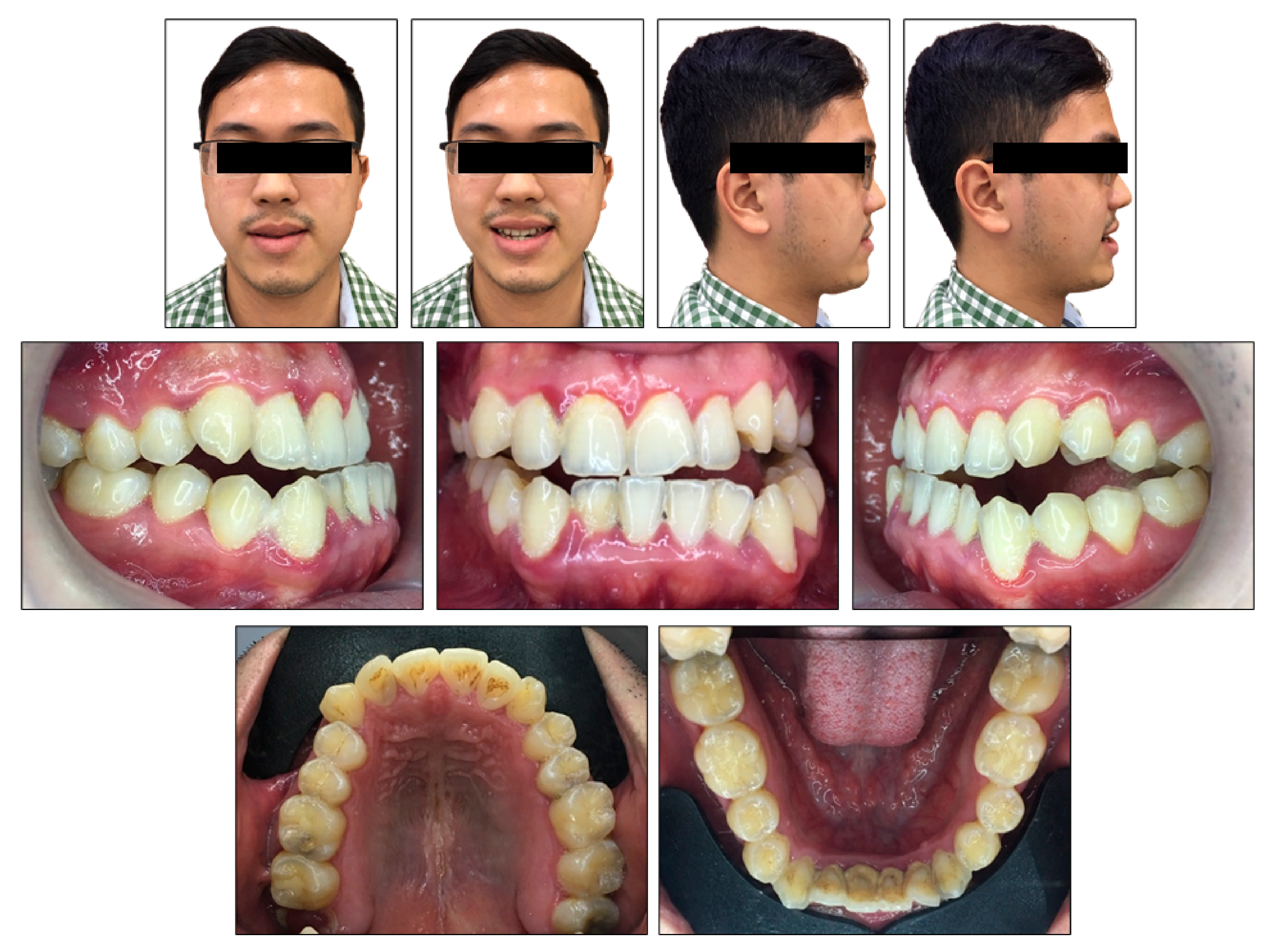 Ijerph 18 05381 g001 Ijerph 18 05381 g001