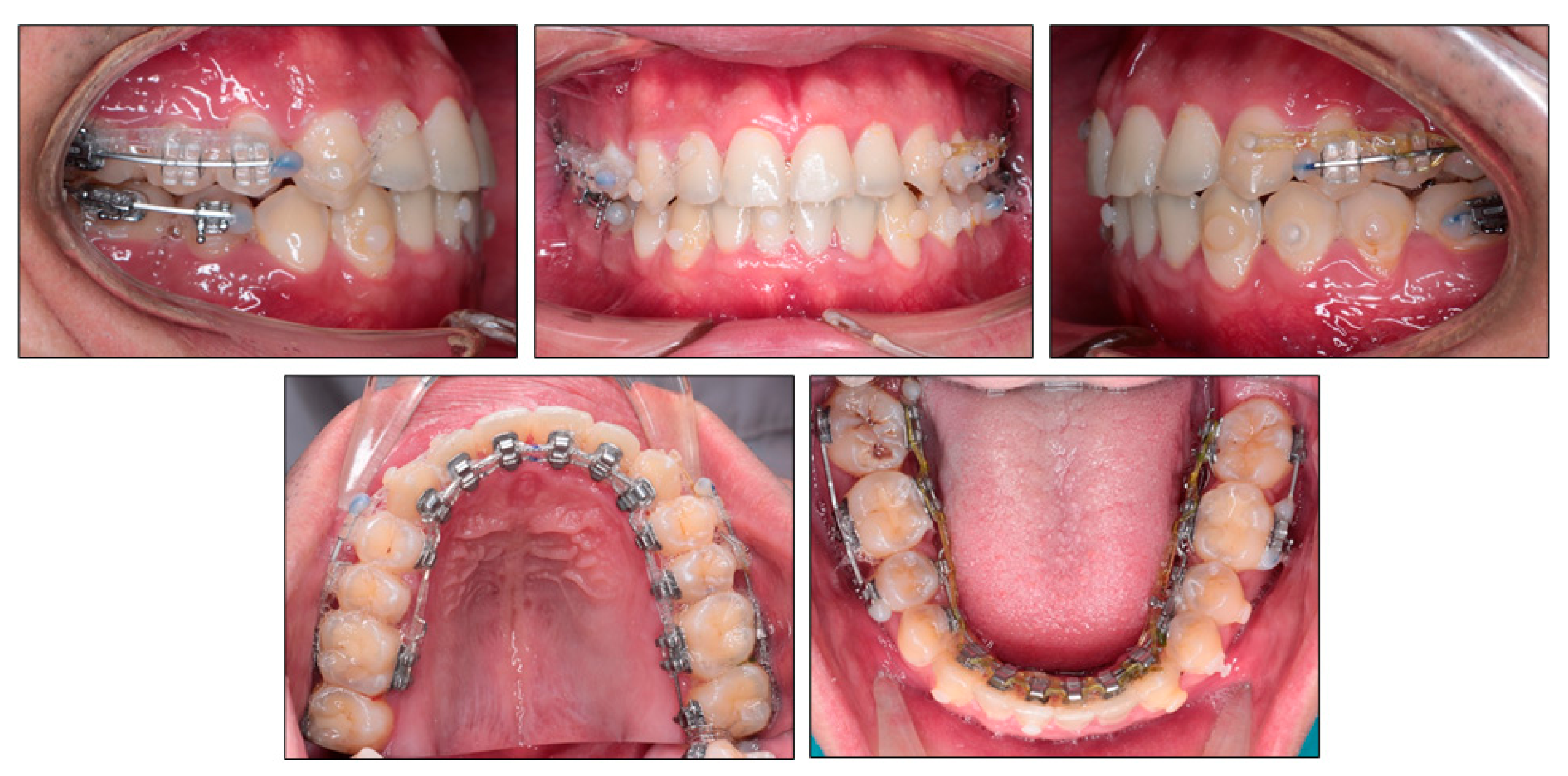 Ijerph 18 05381 g007 Ijerph 18 05381 g007