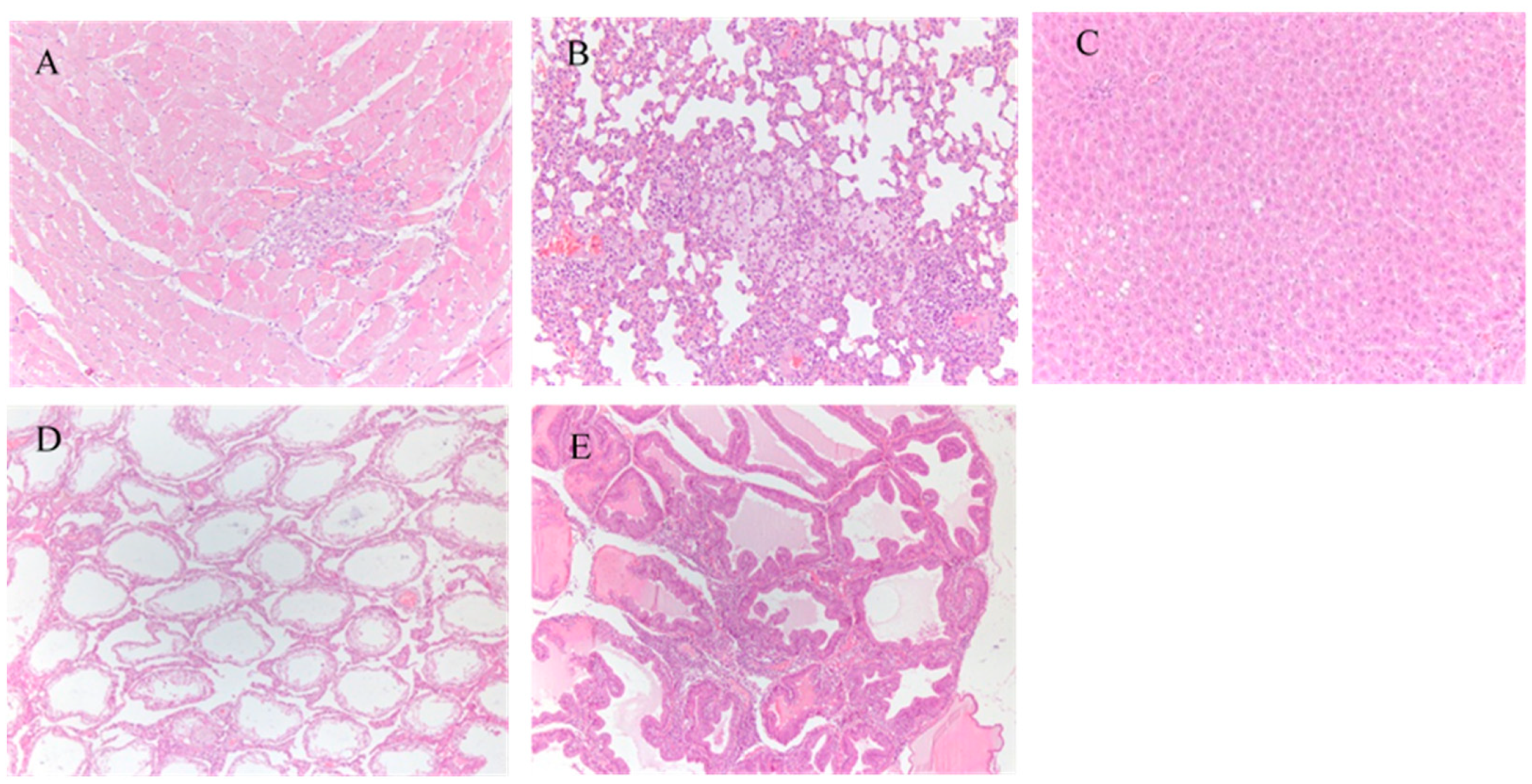Ijerph 18 05526 g005 Ijerph 18 05526 g005