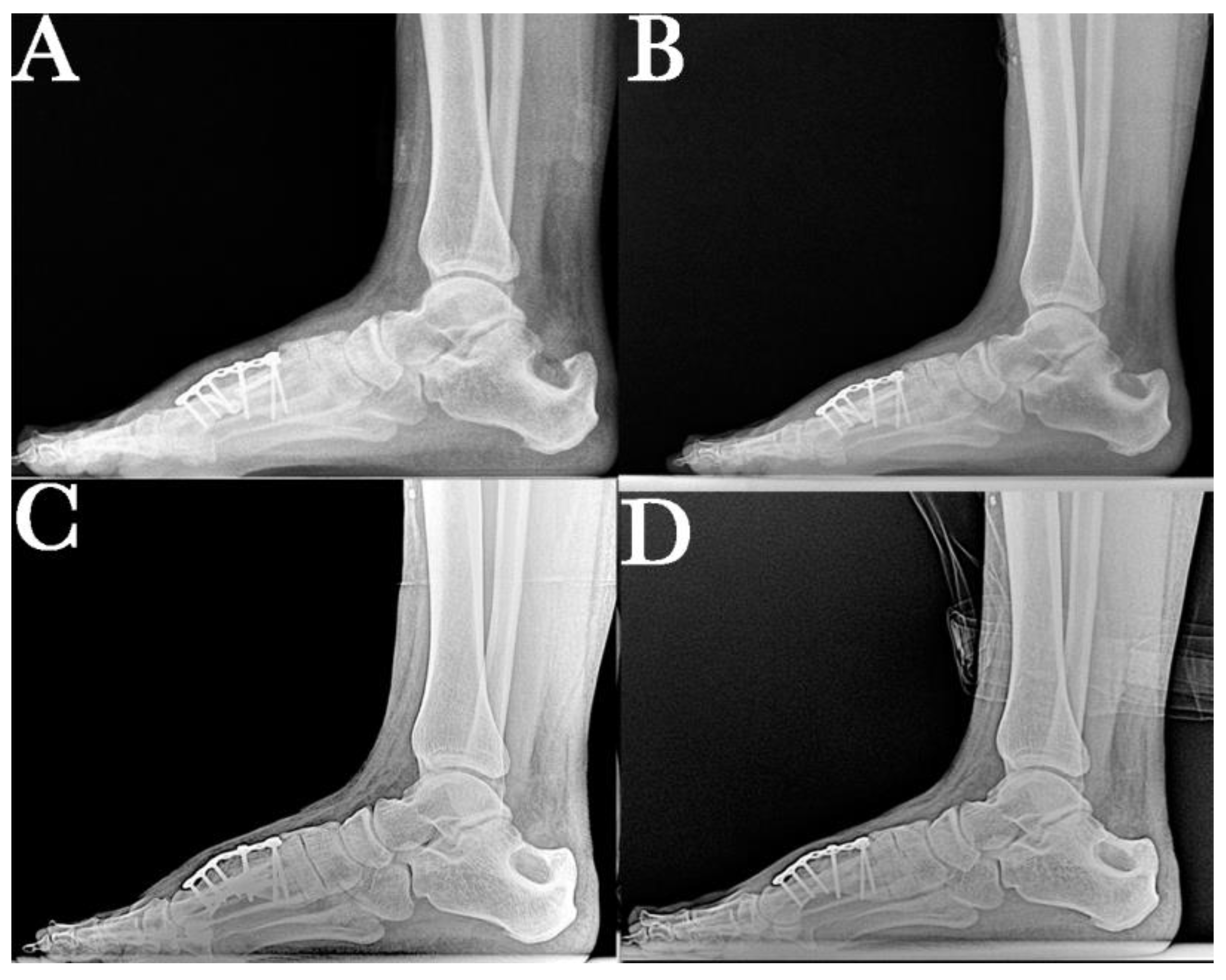Ijerph 18 05620 g005
