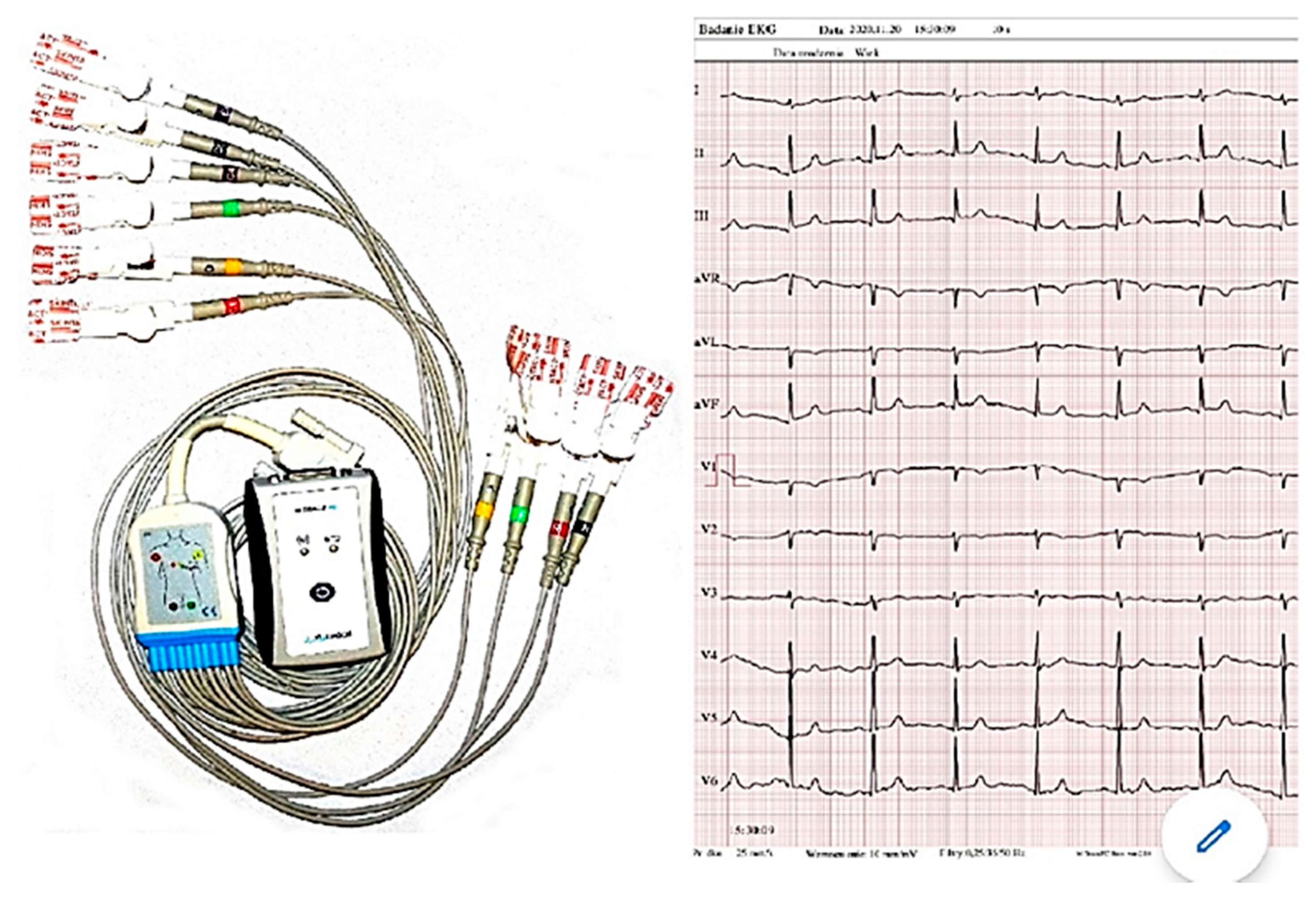 Ijerph 18 05753 g003