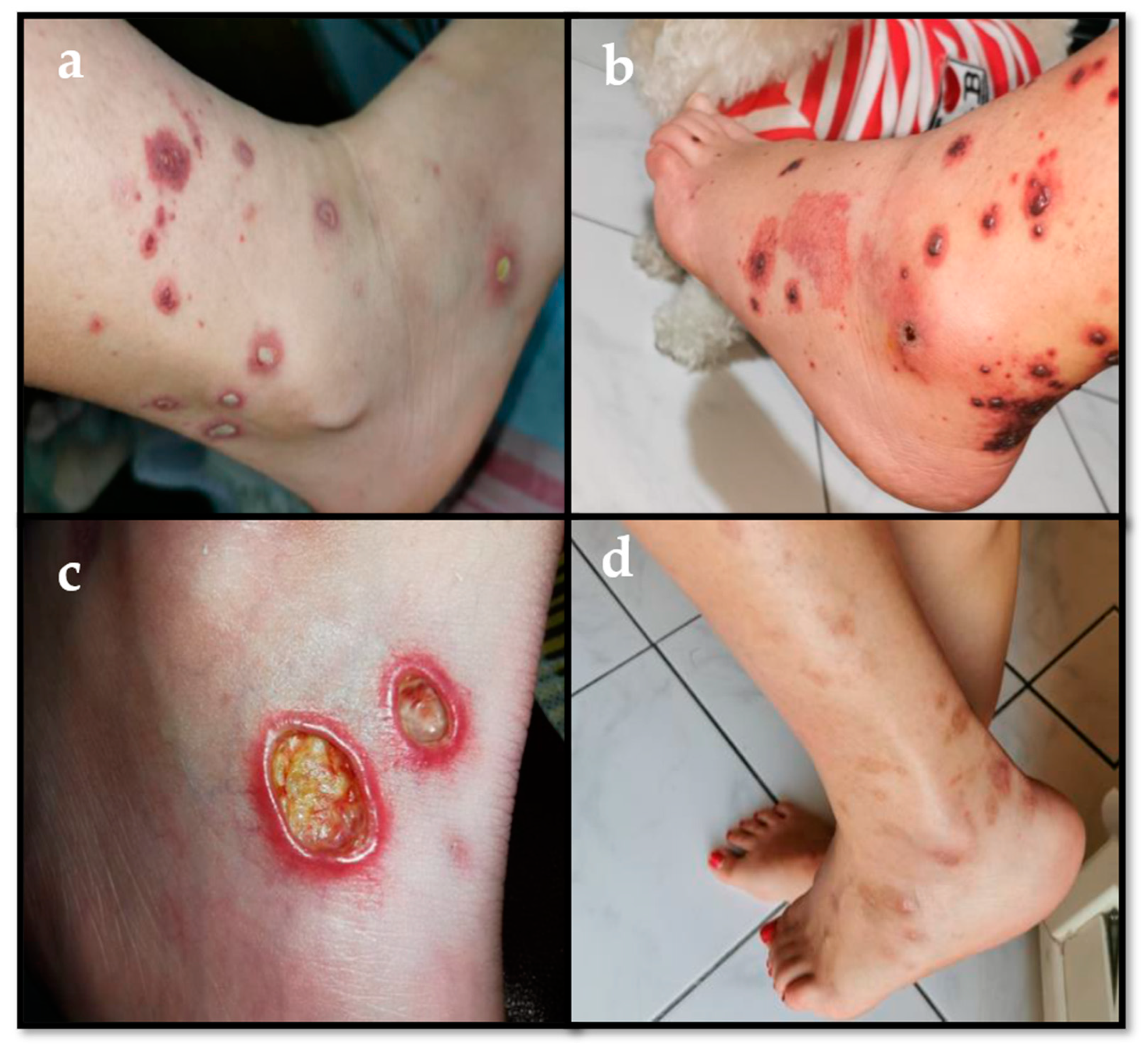 Ijerph 18 06711 g001 Ijerph 18 06711 g001