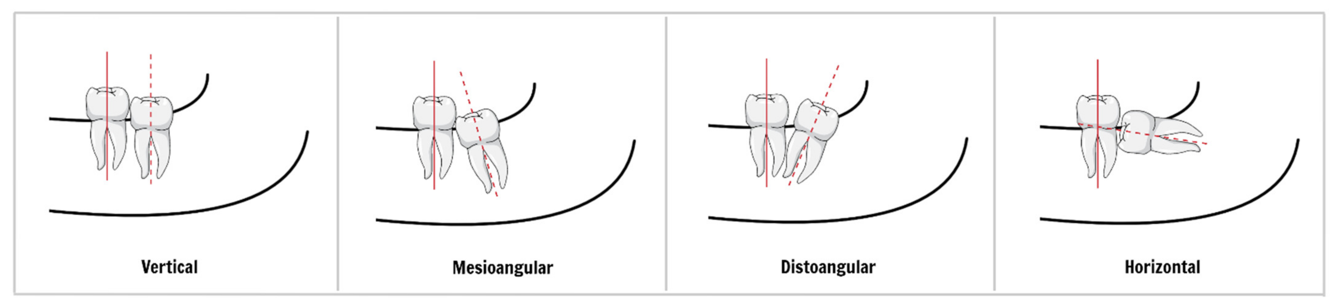 Ijerph 18 06796 g003 Ijerph 18 06796 g003