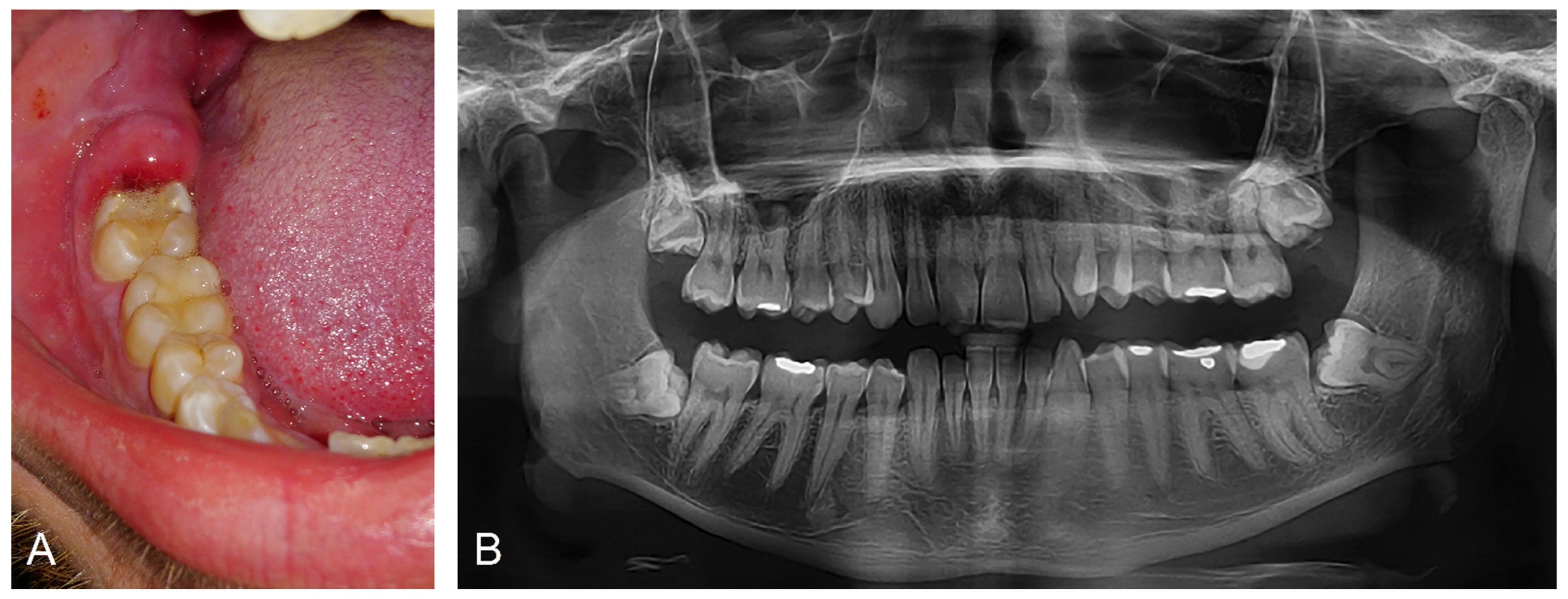 Ijerph 18 06796 g004 Ijerph 18 06796 g004