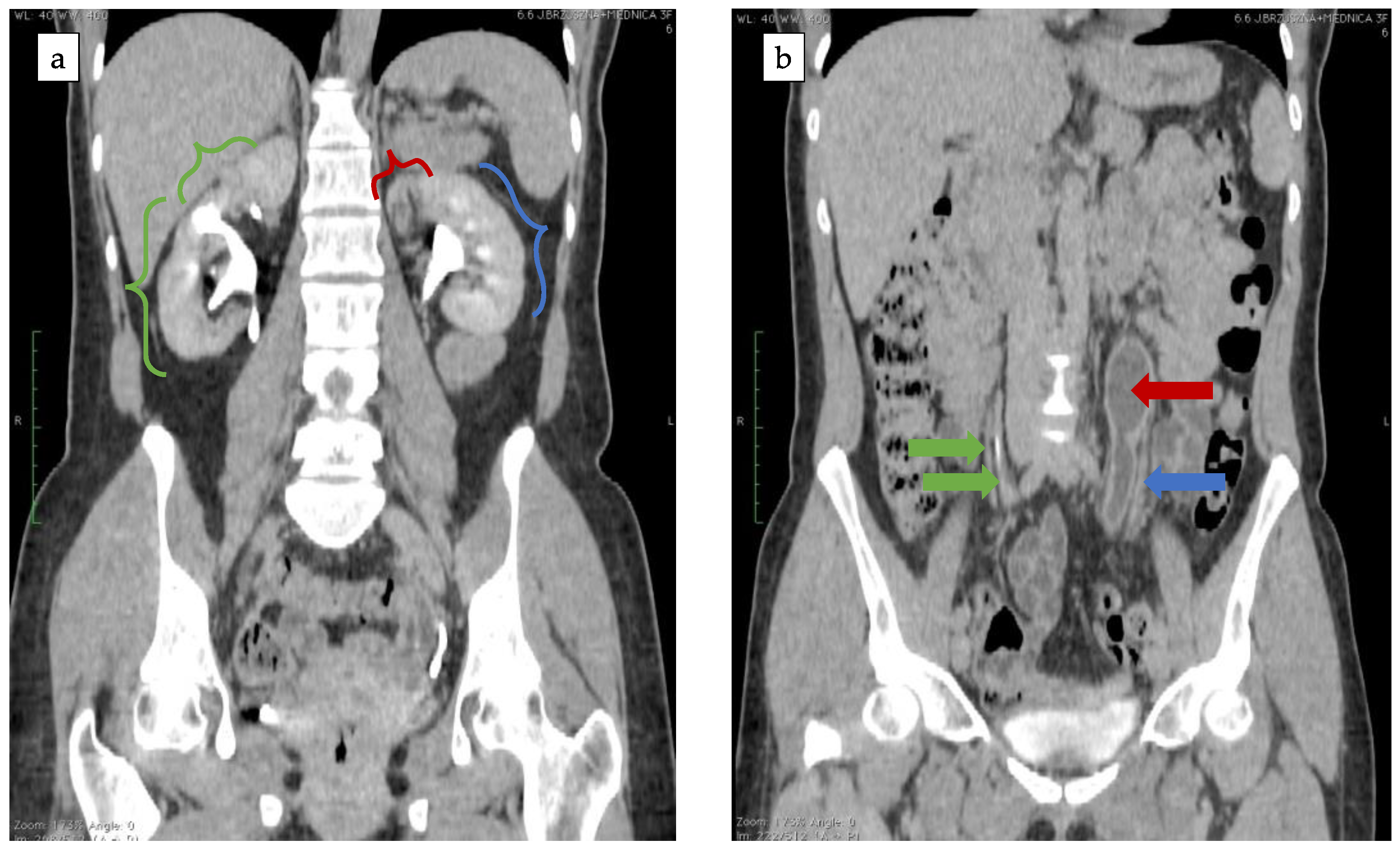 Ijerph 18 07084 g005