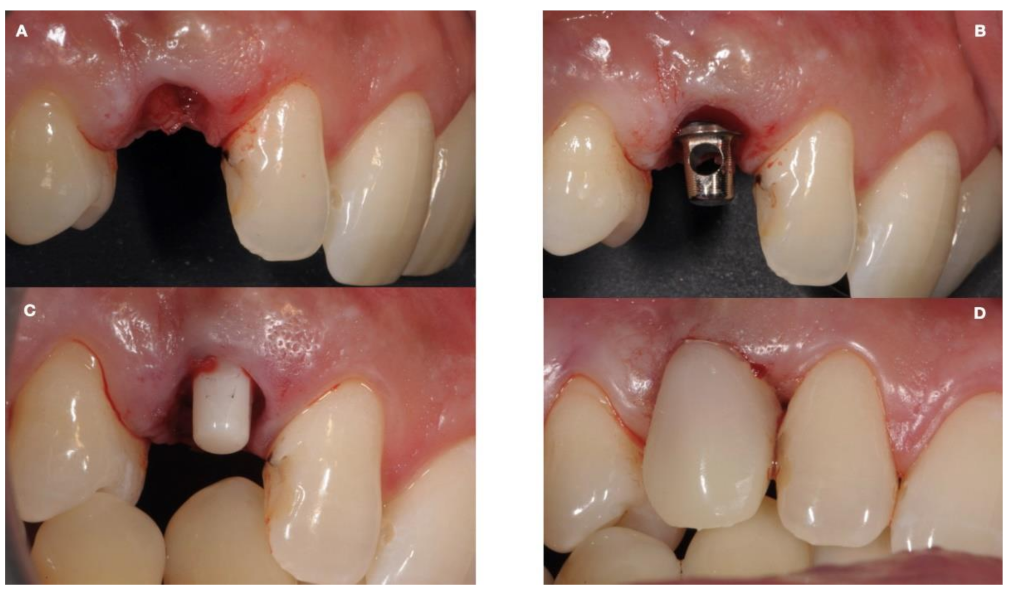 Ijerph 18 07998 g004