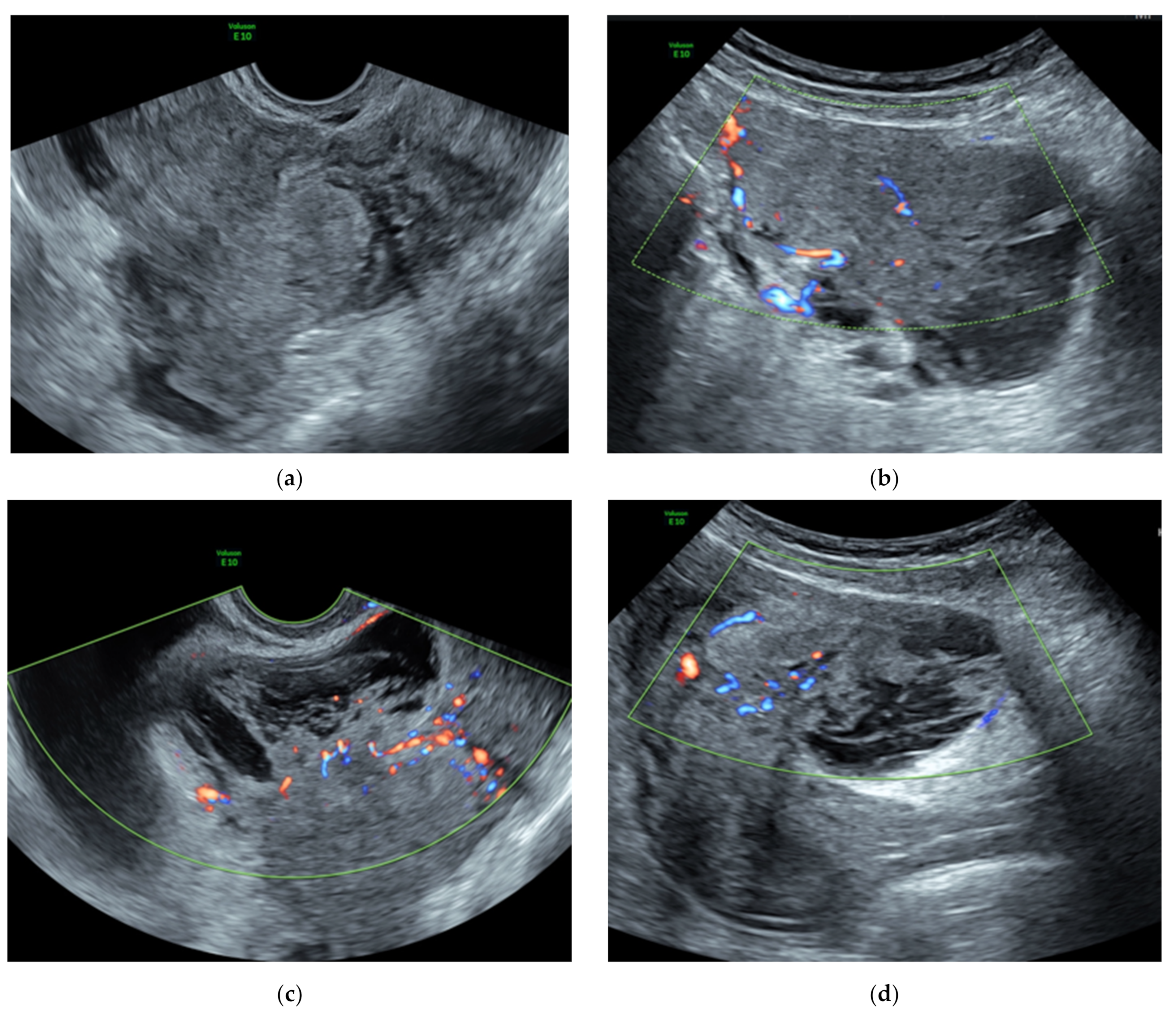 Ijerph 18 08521 g002a