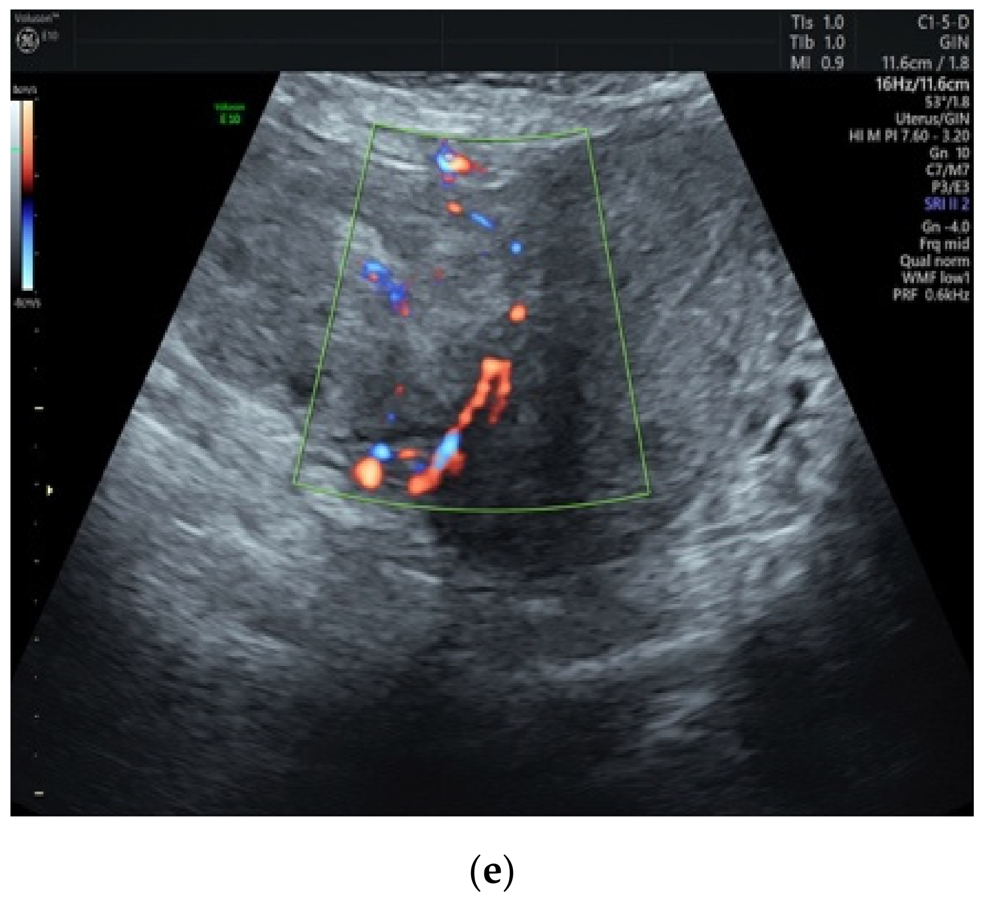 Ijerph 18 08521 g002b