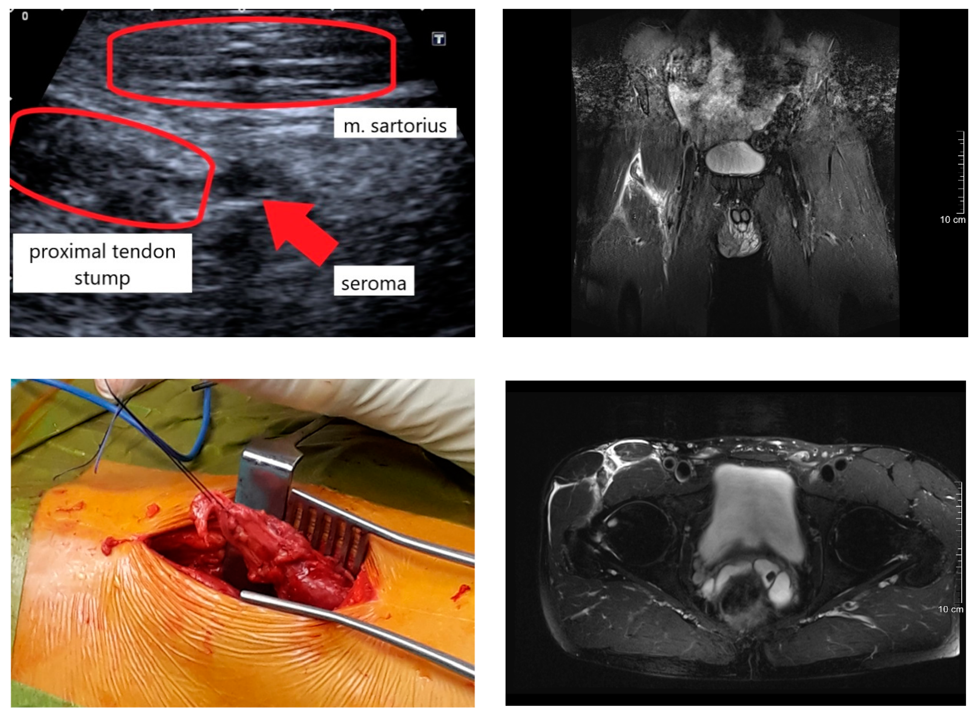 Ijerph 18 08727 g008b