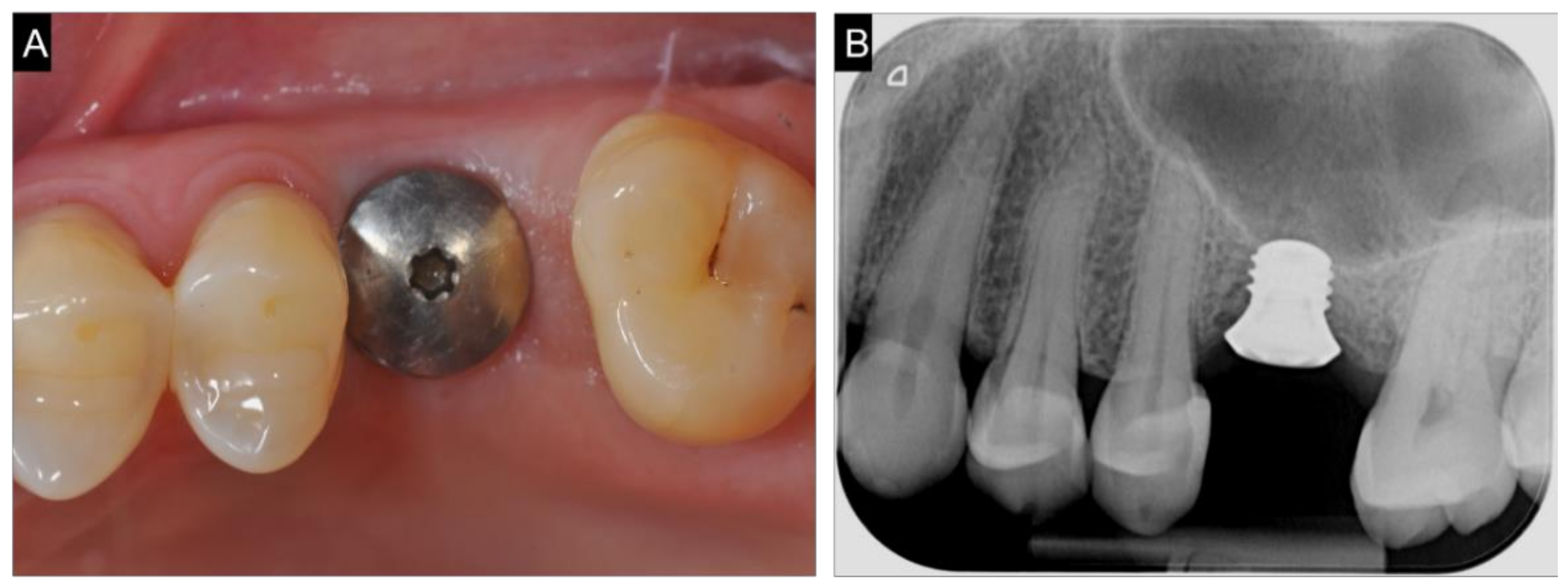 Ijerph 18 09808 g005