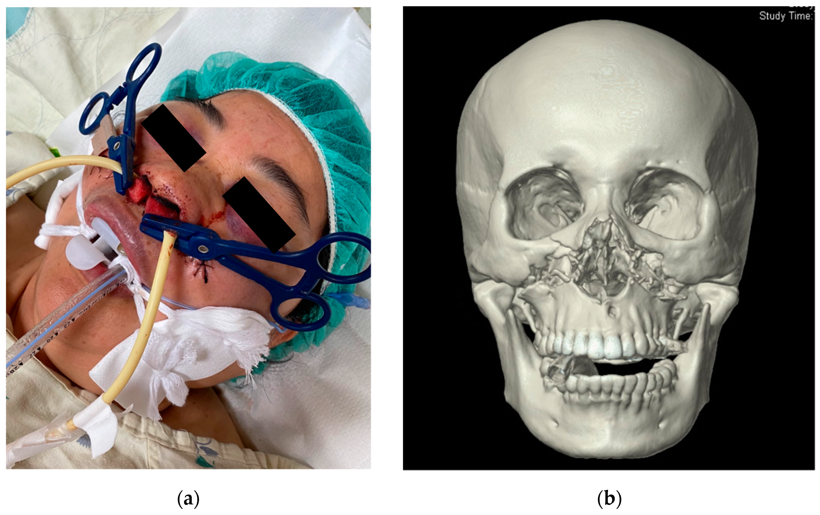 Ijerph 18 11051 g002 Ijerph 18 11051 g002