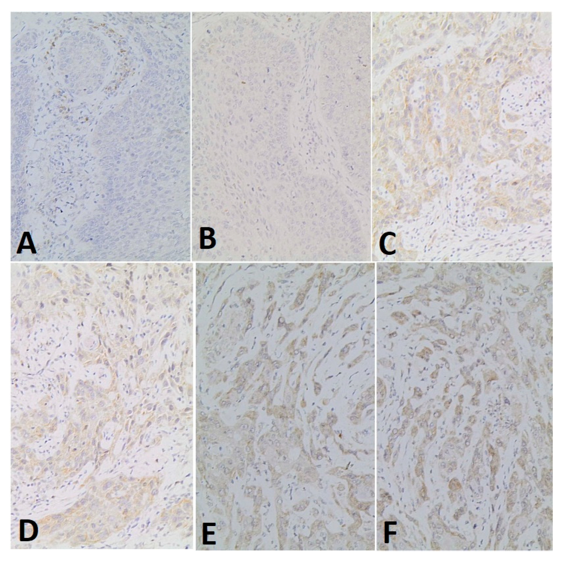 Ijerph 18 11125 g001