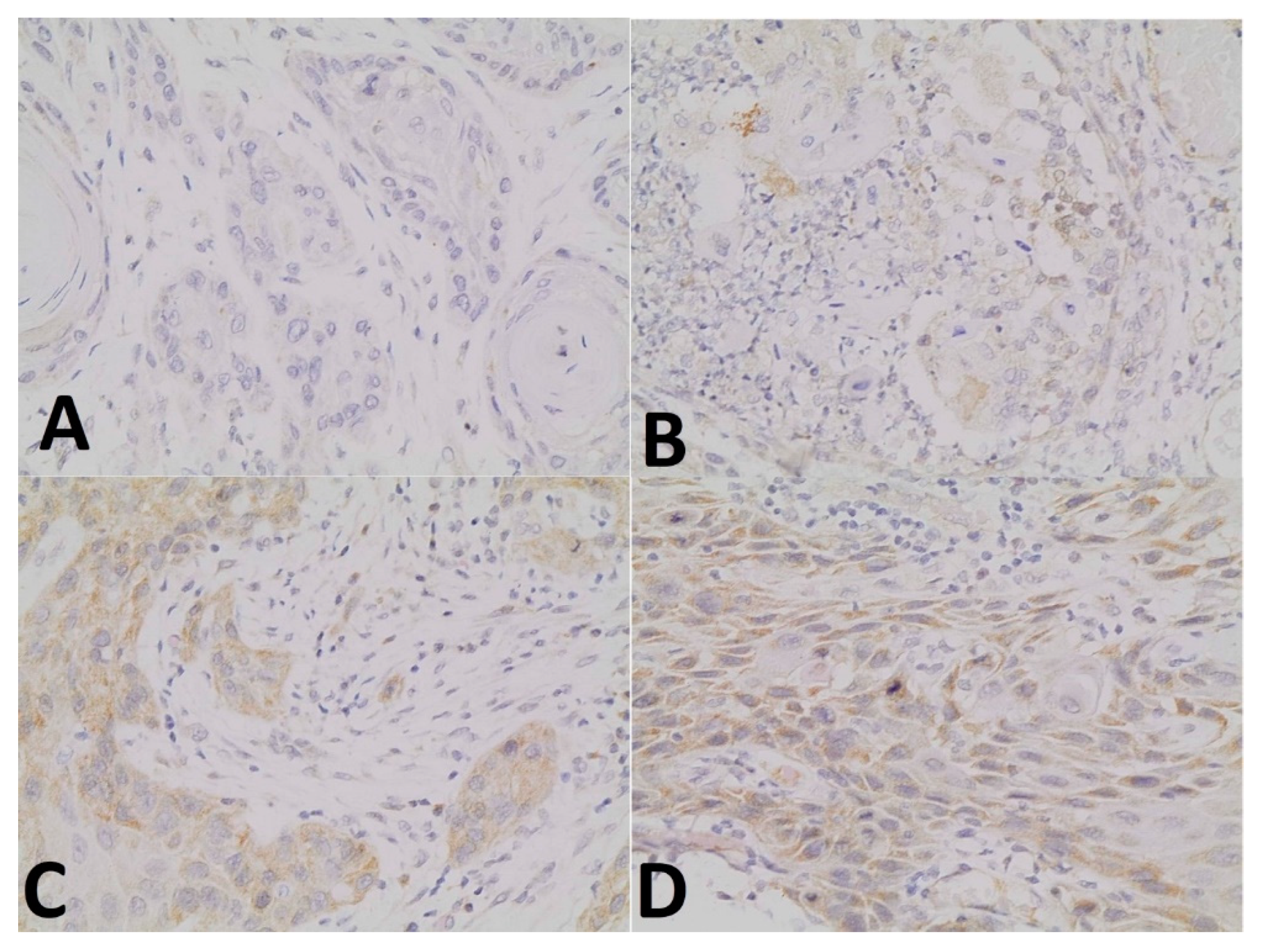 Ijerph 18 11125 g002