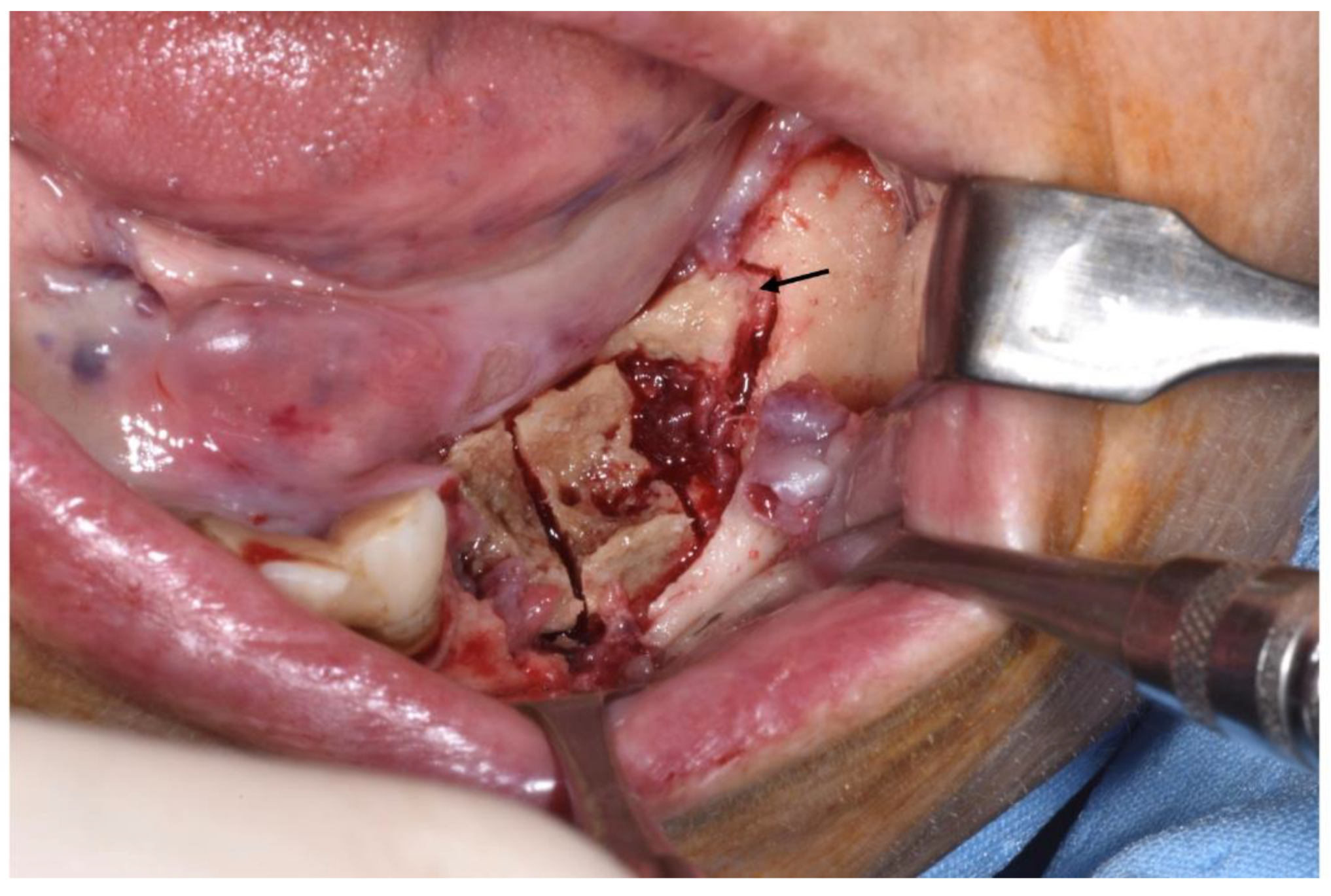 Ijerph 18 11362 g005