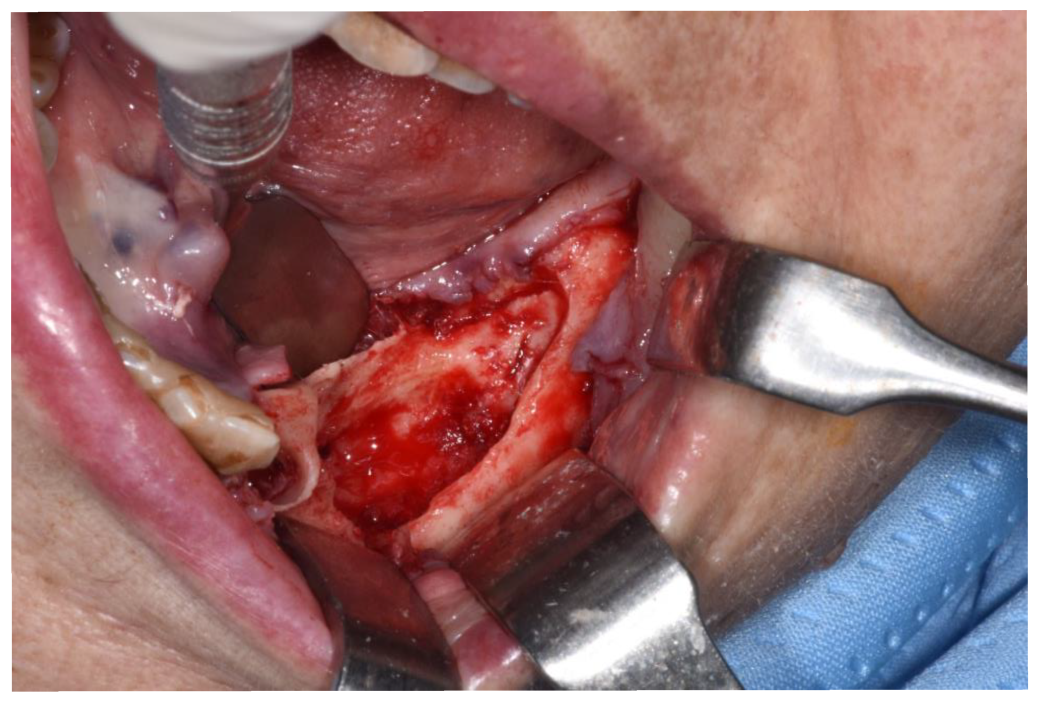 Ijerph 18 11362 g006