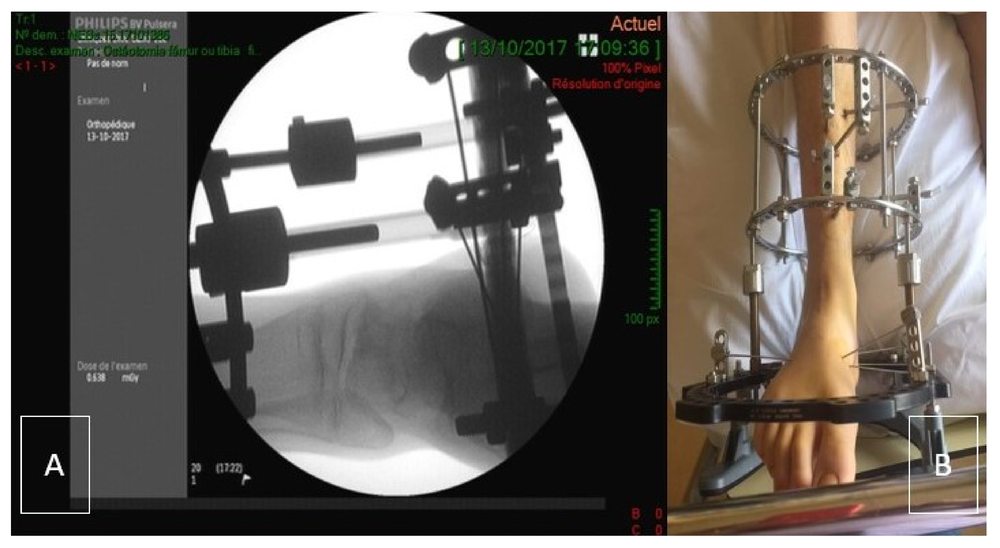 Ijerph 18 11405 g001