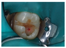 Ijerph 18 12585 i005