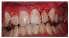 Ijerph 18 12585 i006