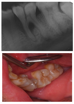 Ijerph 18 12585 i010