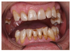 Ijerph 18 12585 i011