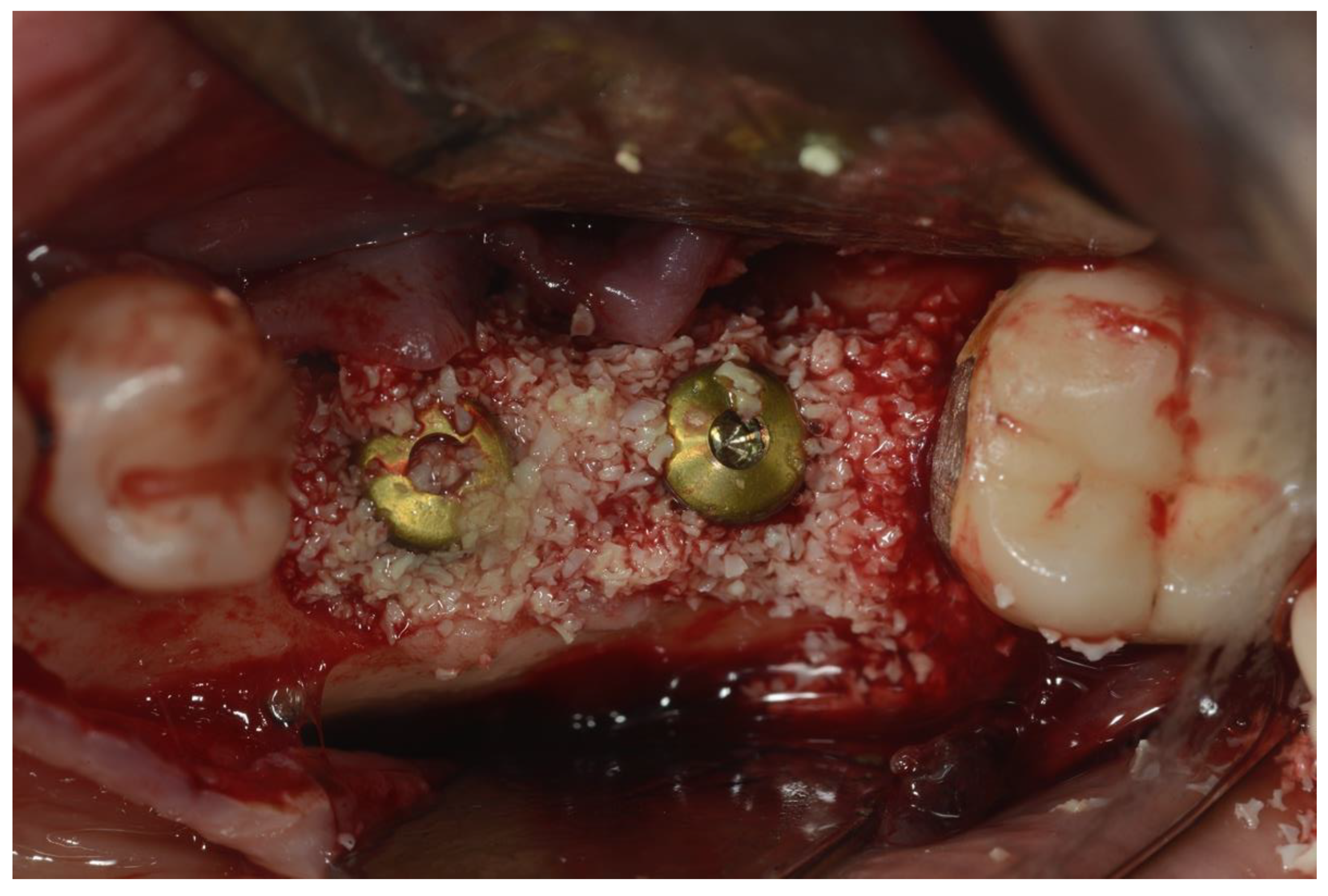 Ijerph 18 12658 g004