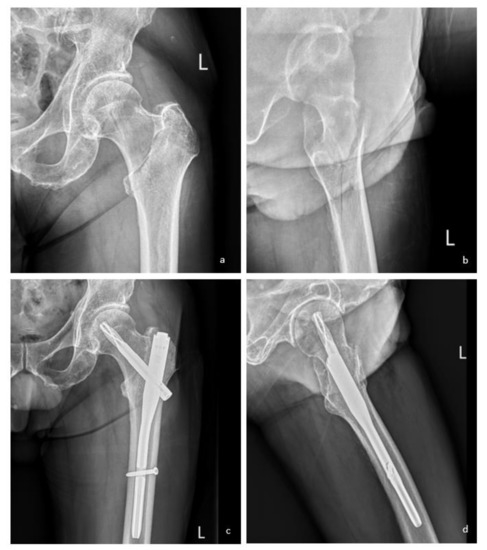 Ijerph 19 00177 g0a4