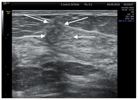 Ijerph 19 00448 g0a2 550