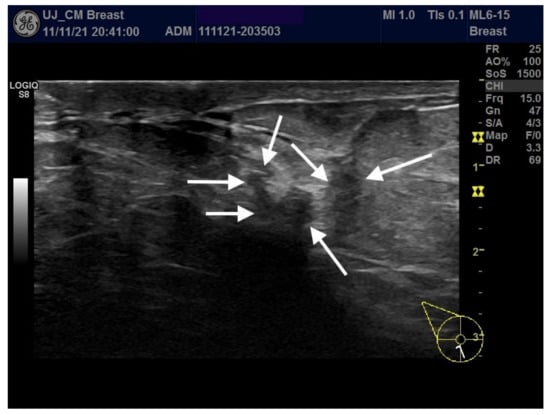 Ijerph 19 00448 g0a3 550