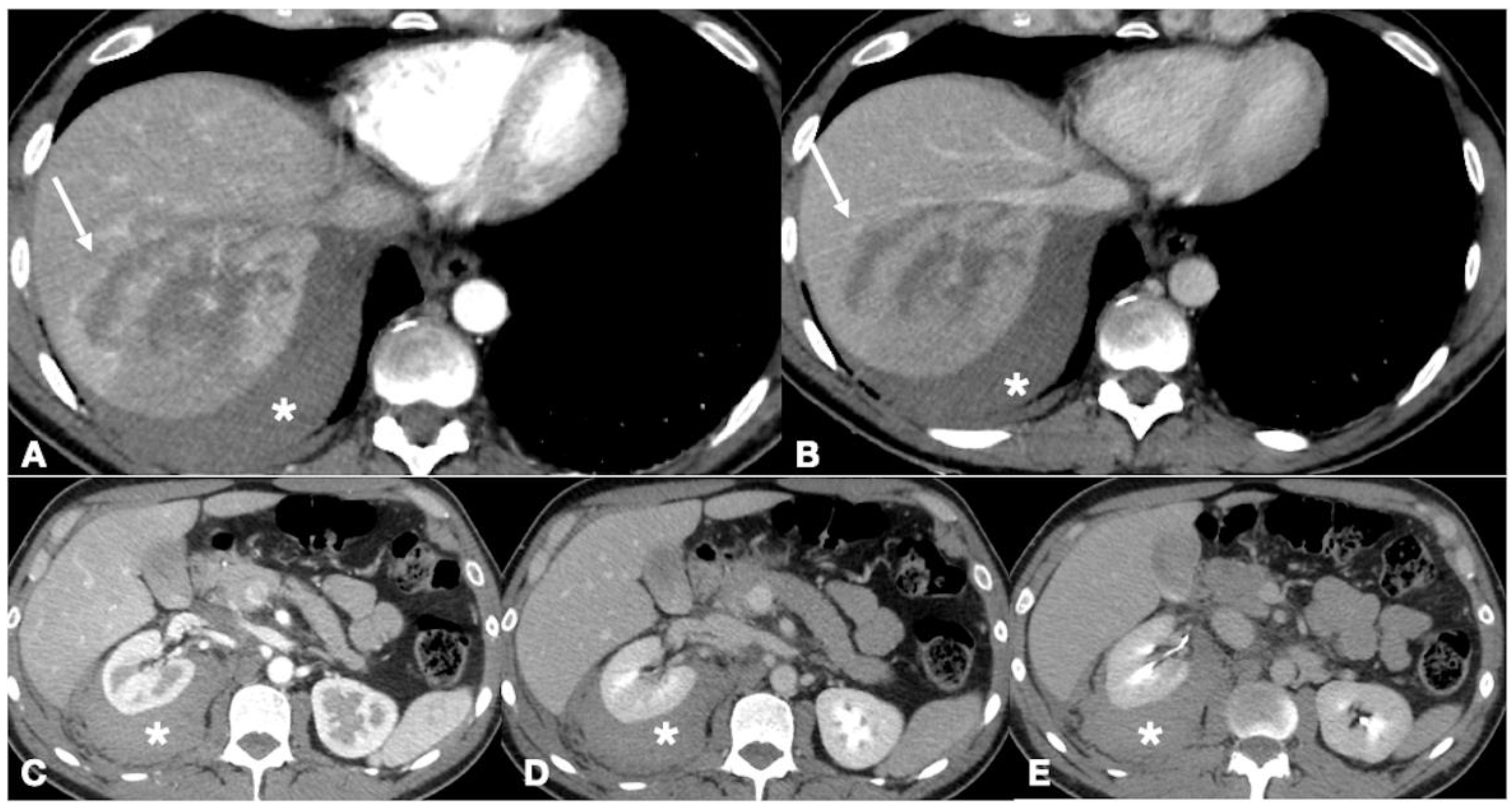 Ijerph 19 00539 g005