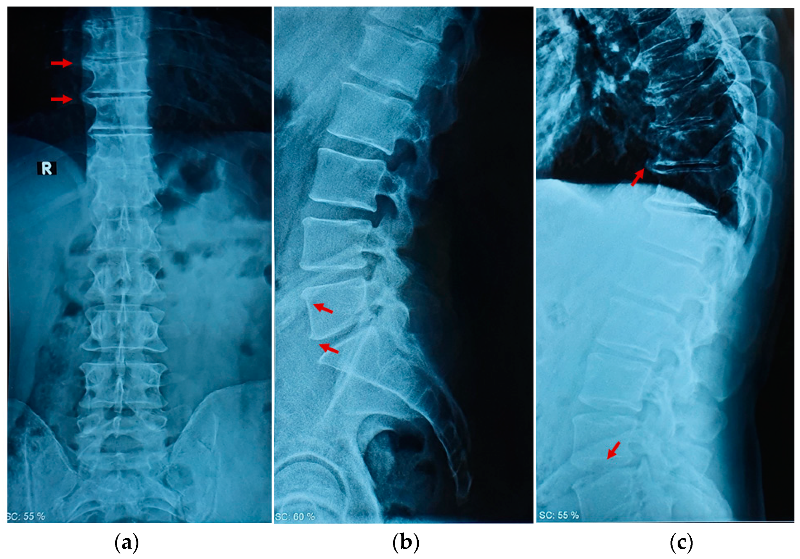 Ijerph 19 00961 g001