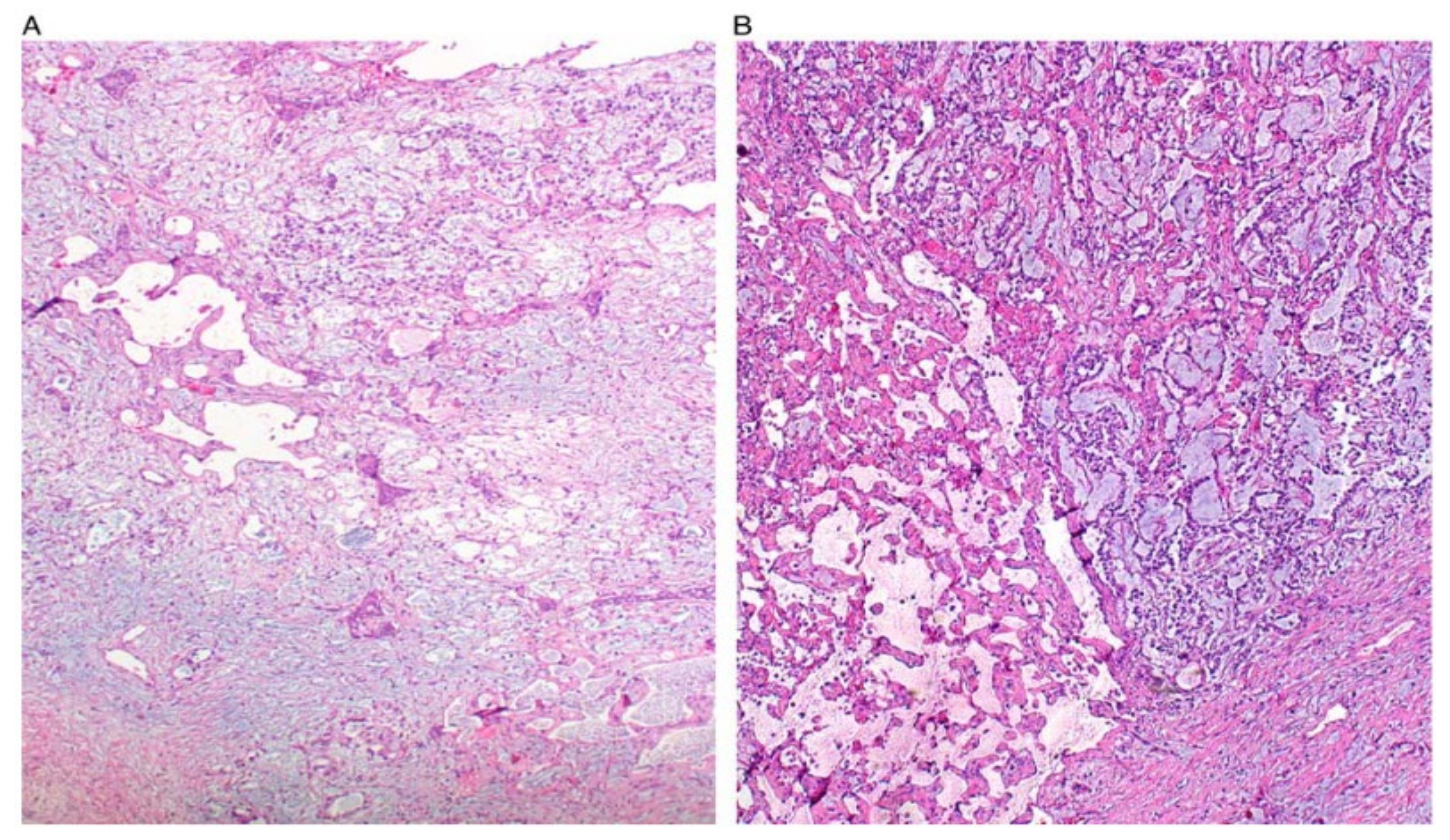 Ijerph 19 01106 g005