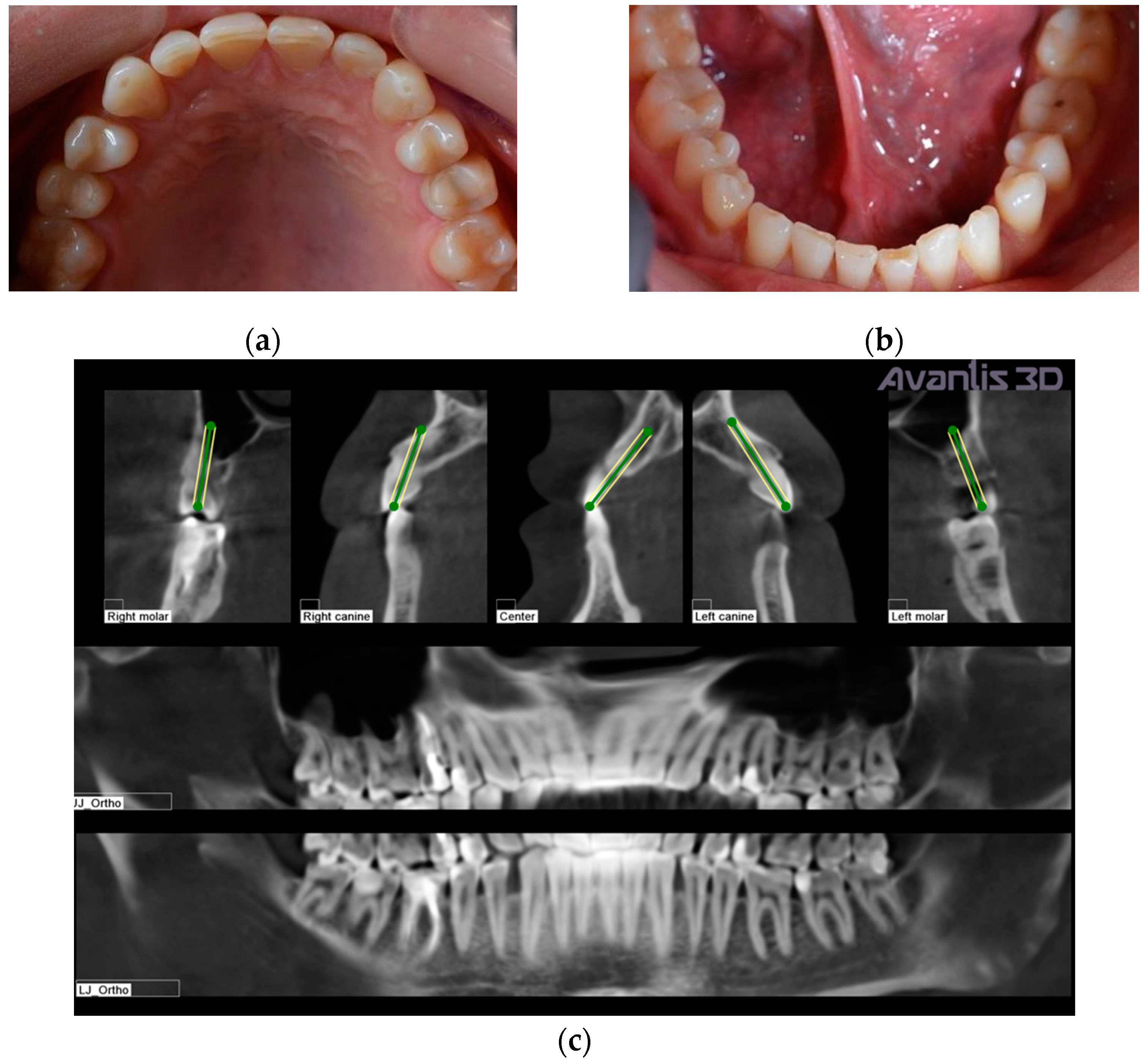 Ijerph 19 01474 g002