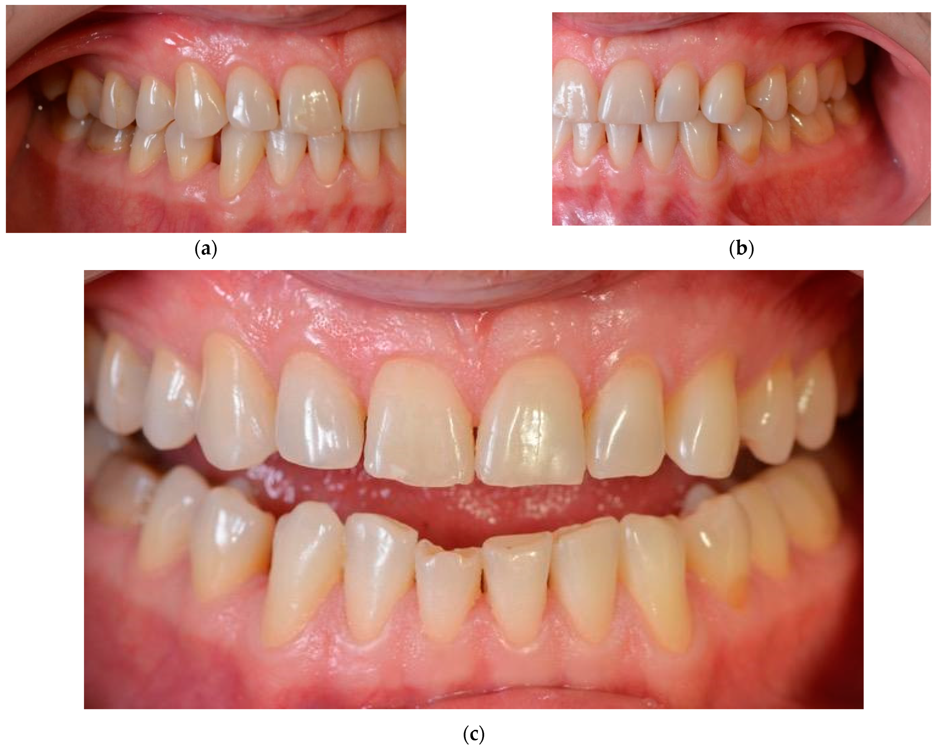 Ijerph 19 01474 g004