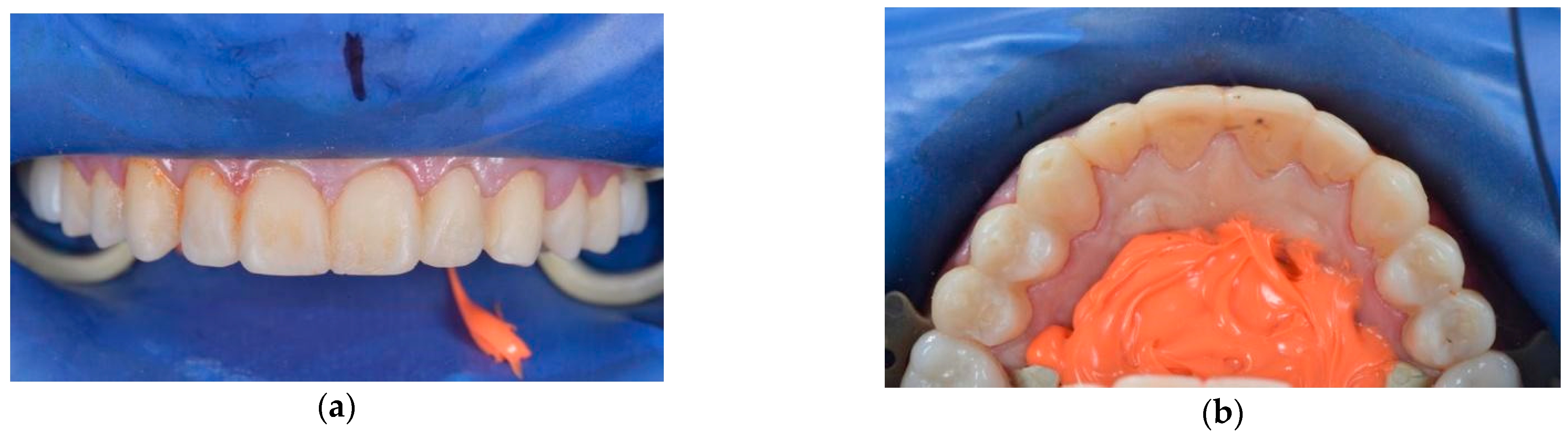 Ijerph 19 01474 g010